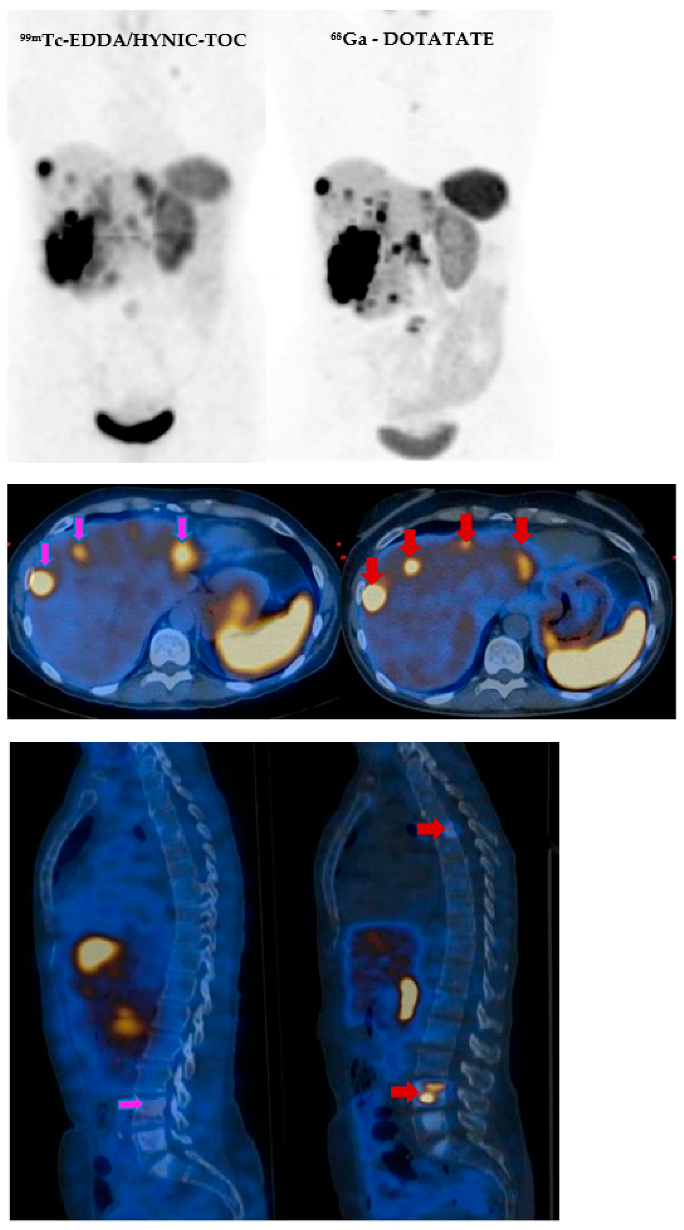 Cancers 14 02725 g005