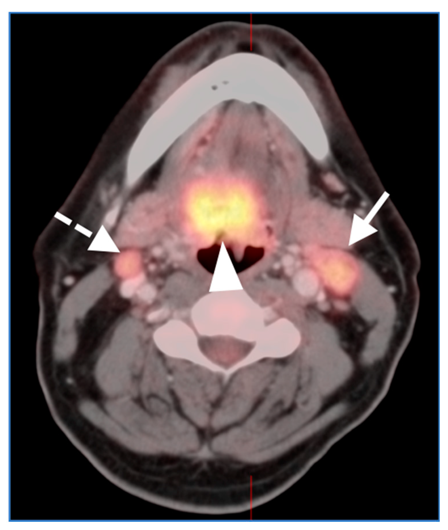 Cancers 14 02726 g002