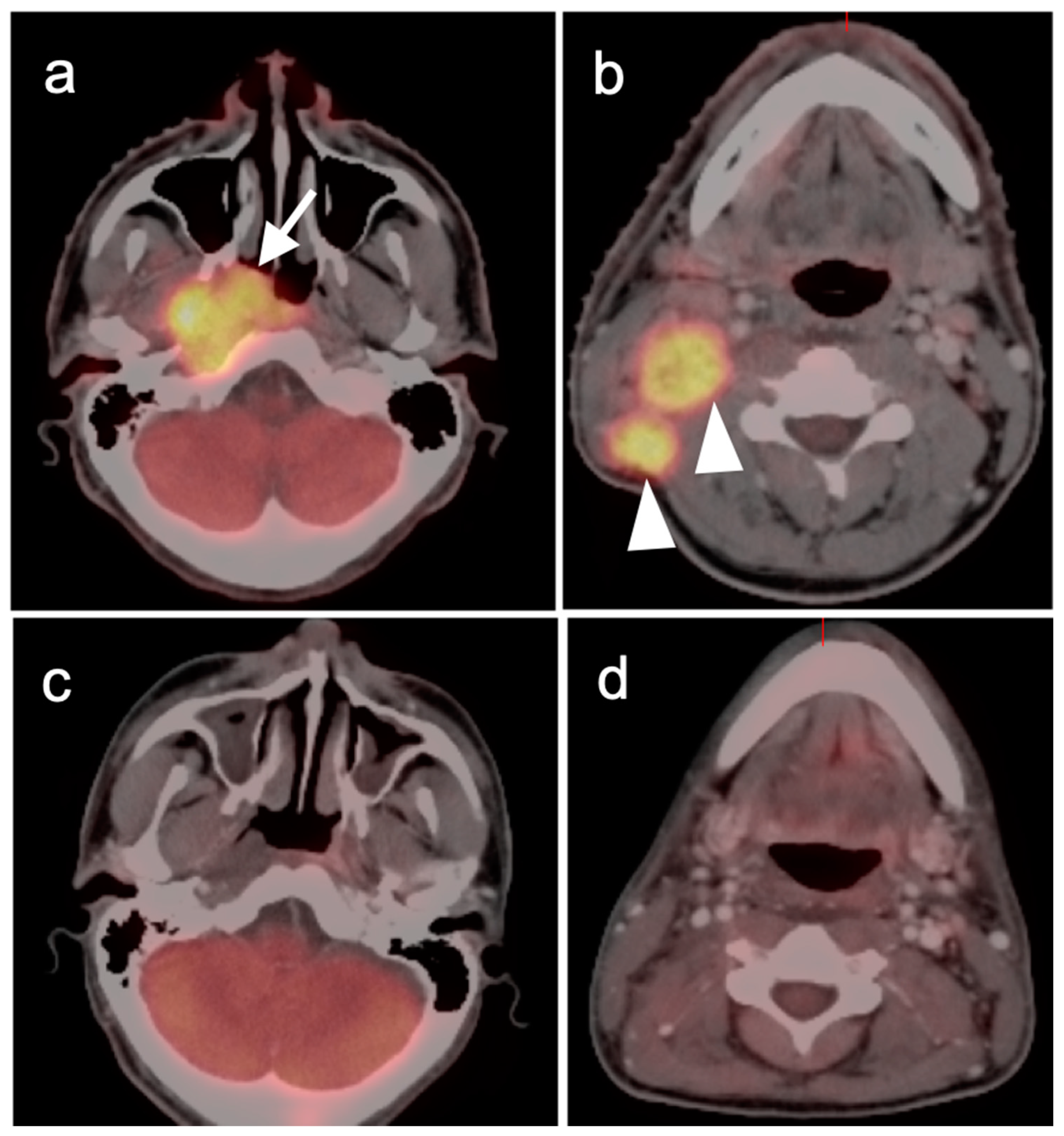 Cancers 14 02726 g003