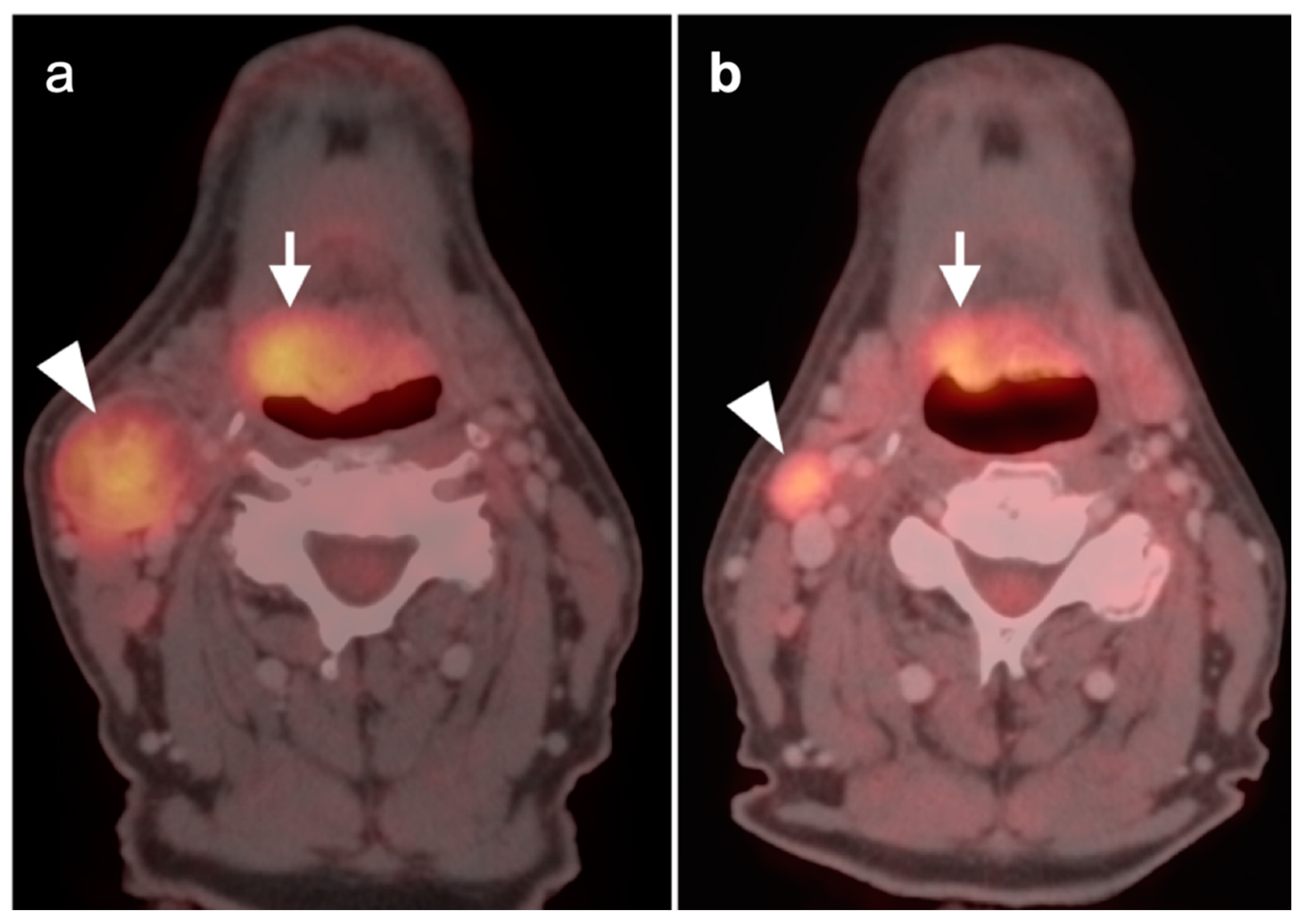 Cancers 14 02726 g004
