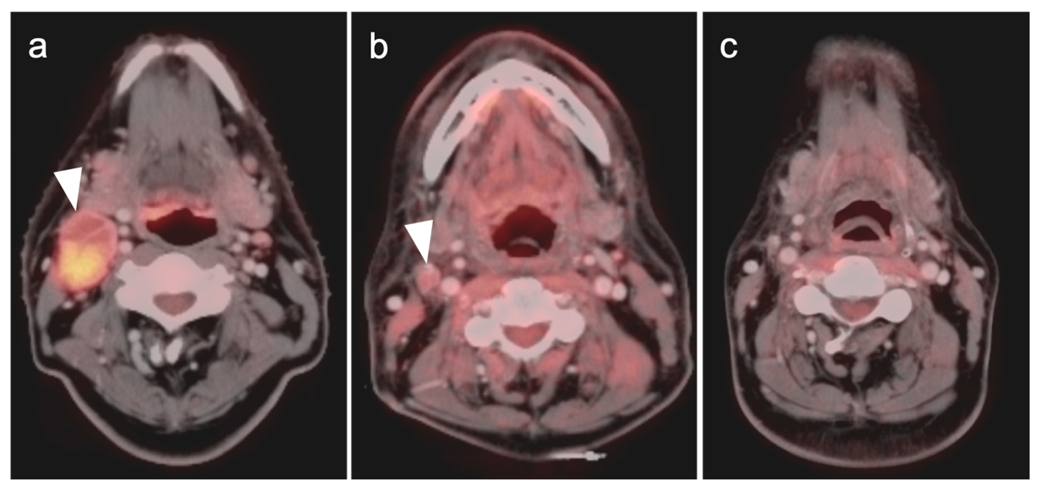 Cancers 14 02726 g005