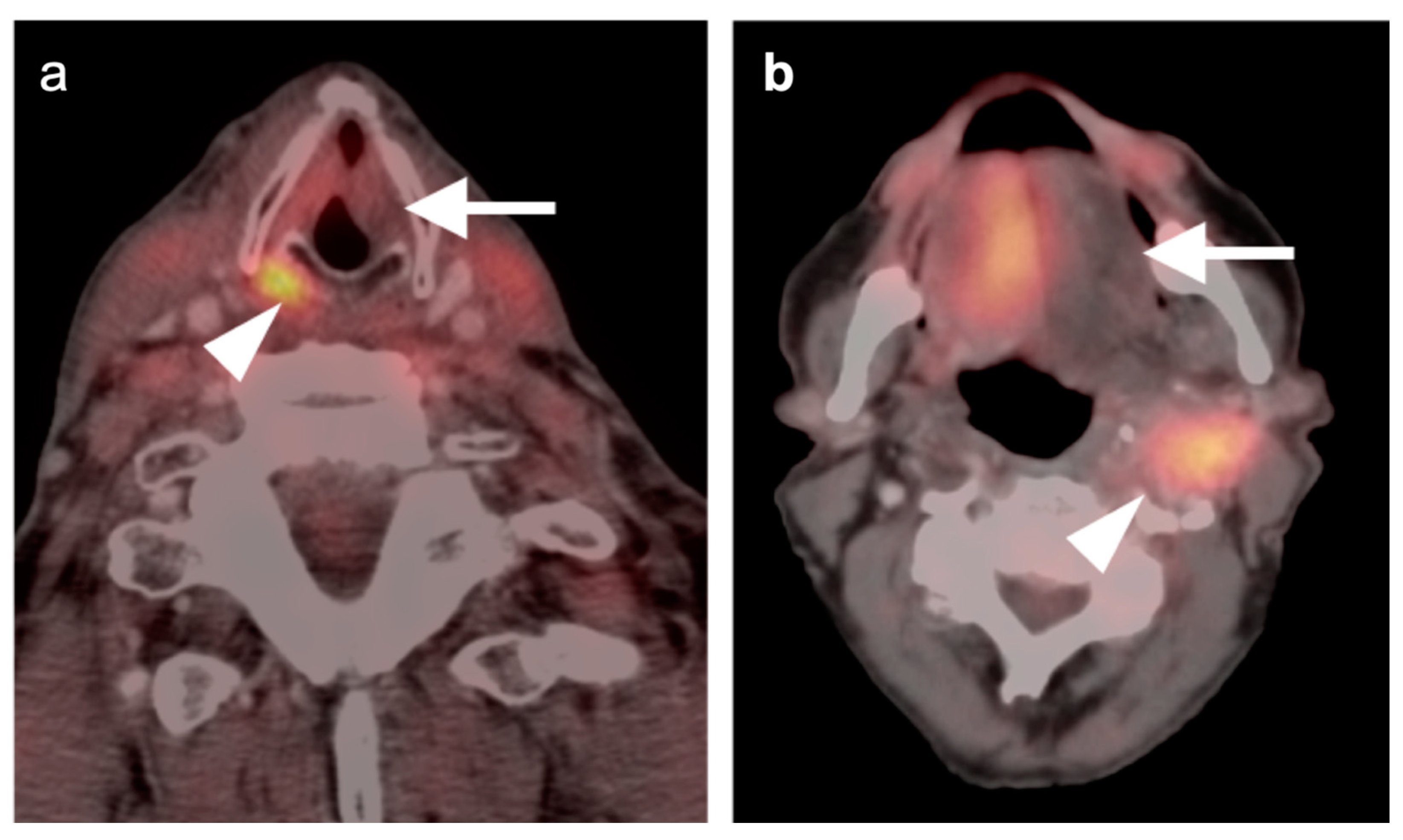 Cancers 14 02726 g006