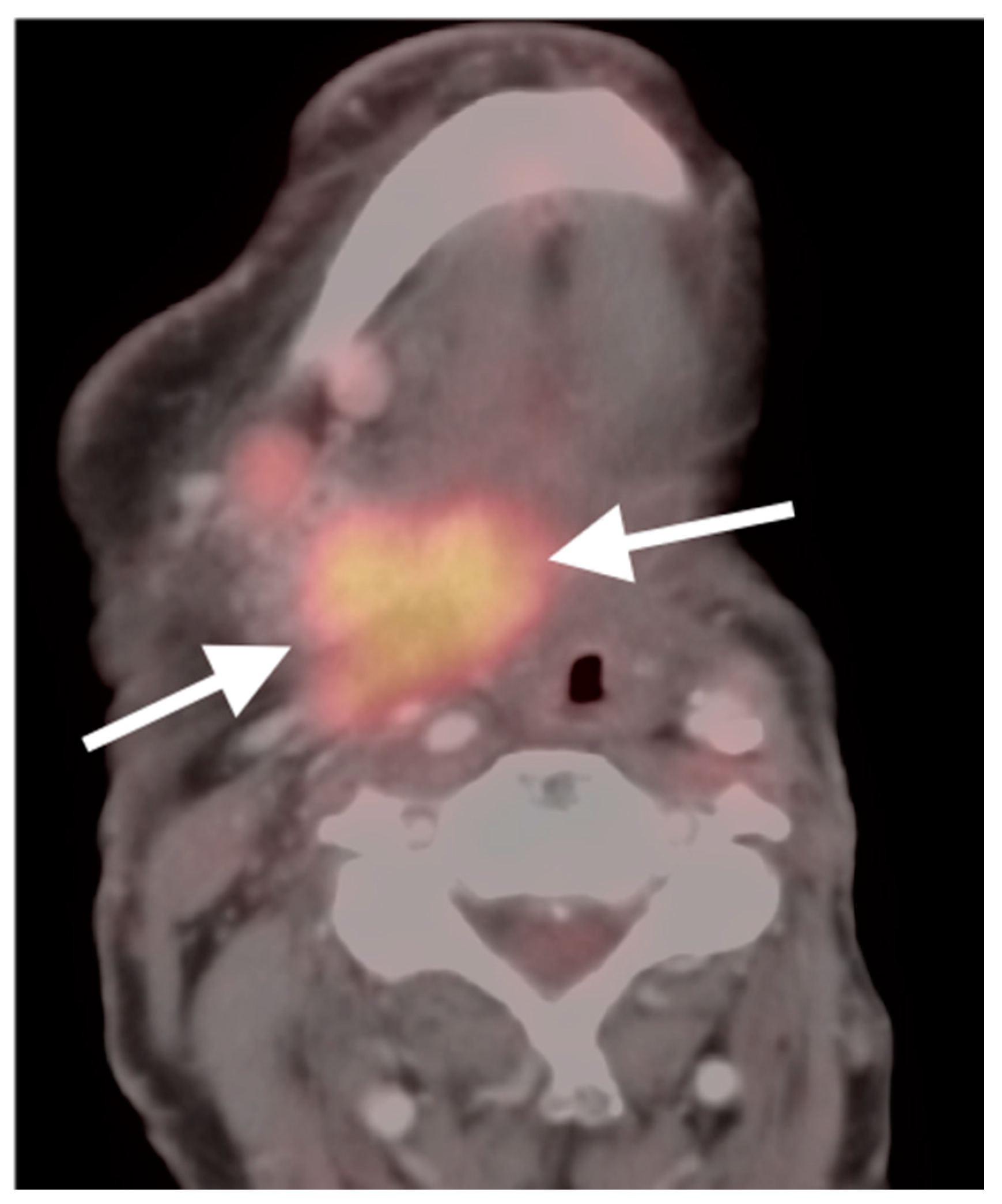 Cancers 14 02726 g007