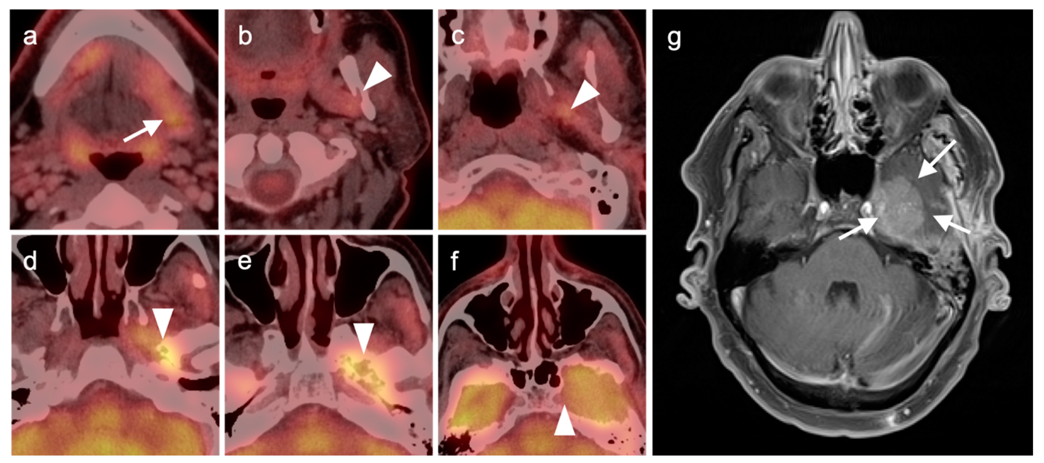 Cancers 14 02726 g009