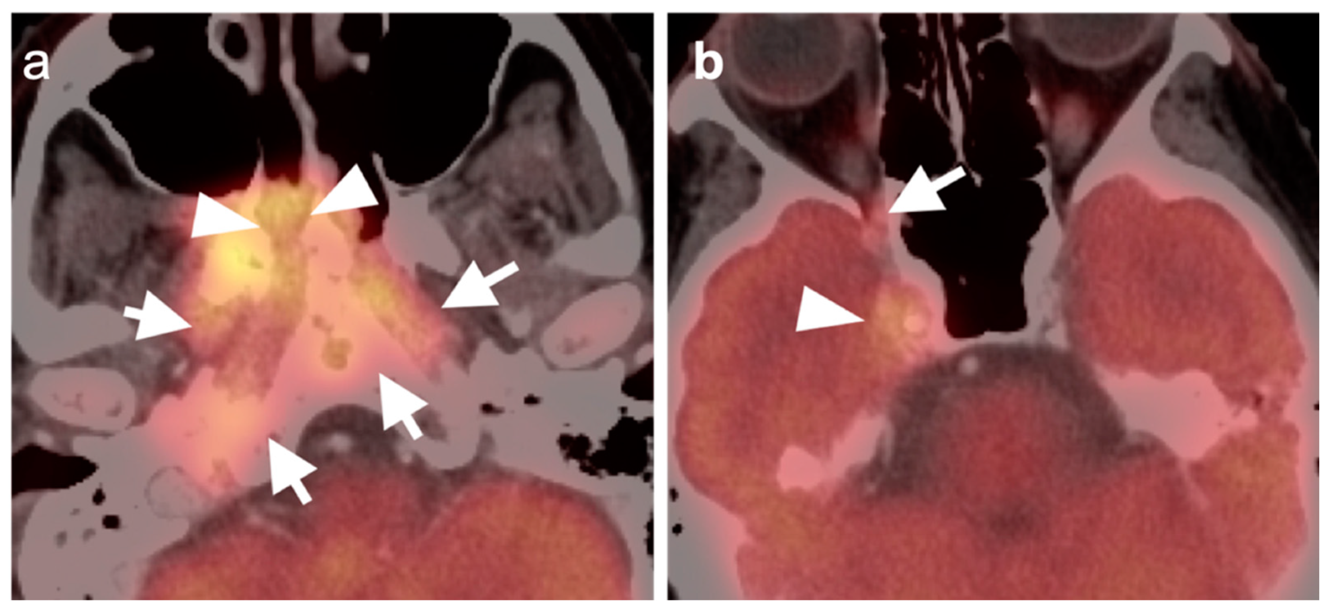 Cancers 14 02726 g010