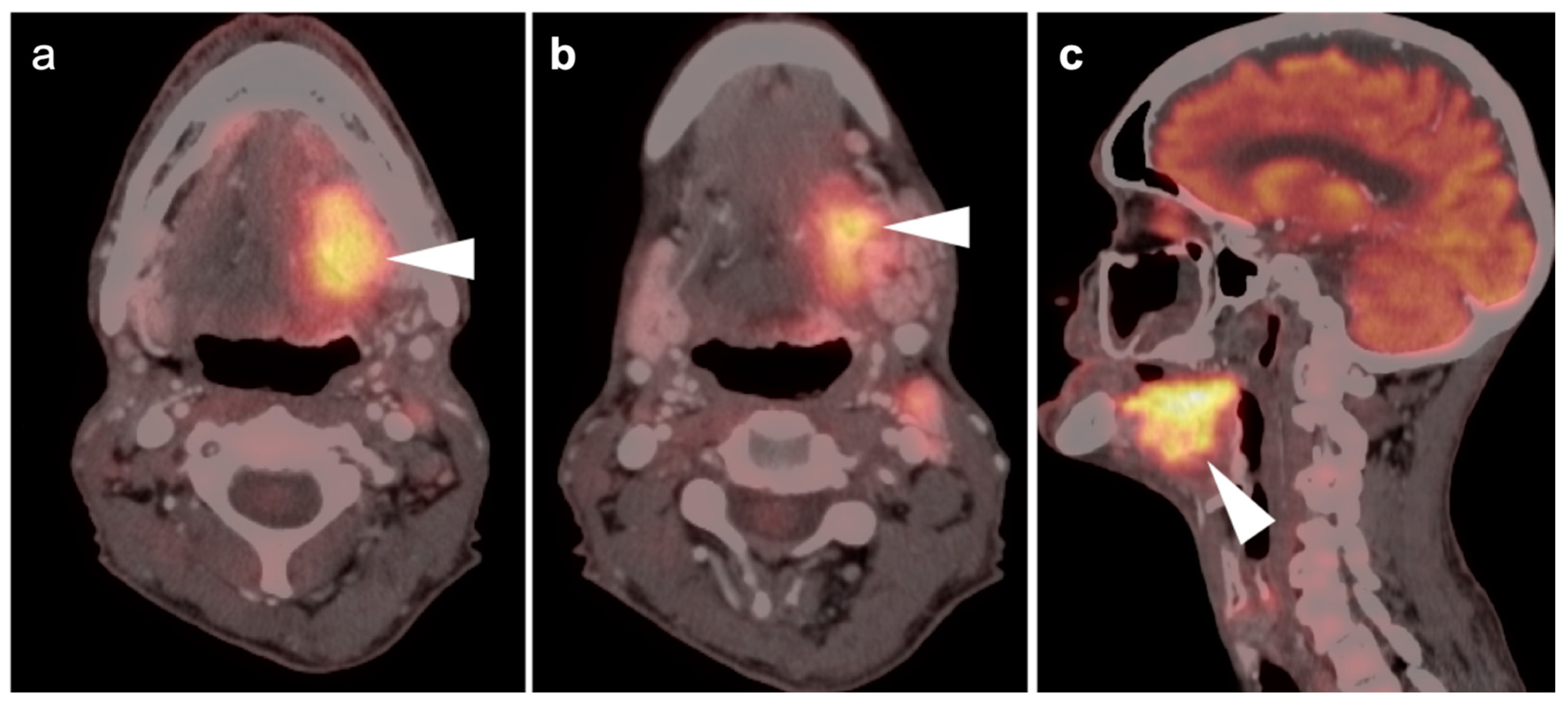 Cancers 14 02726 g011