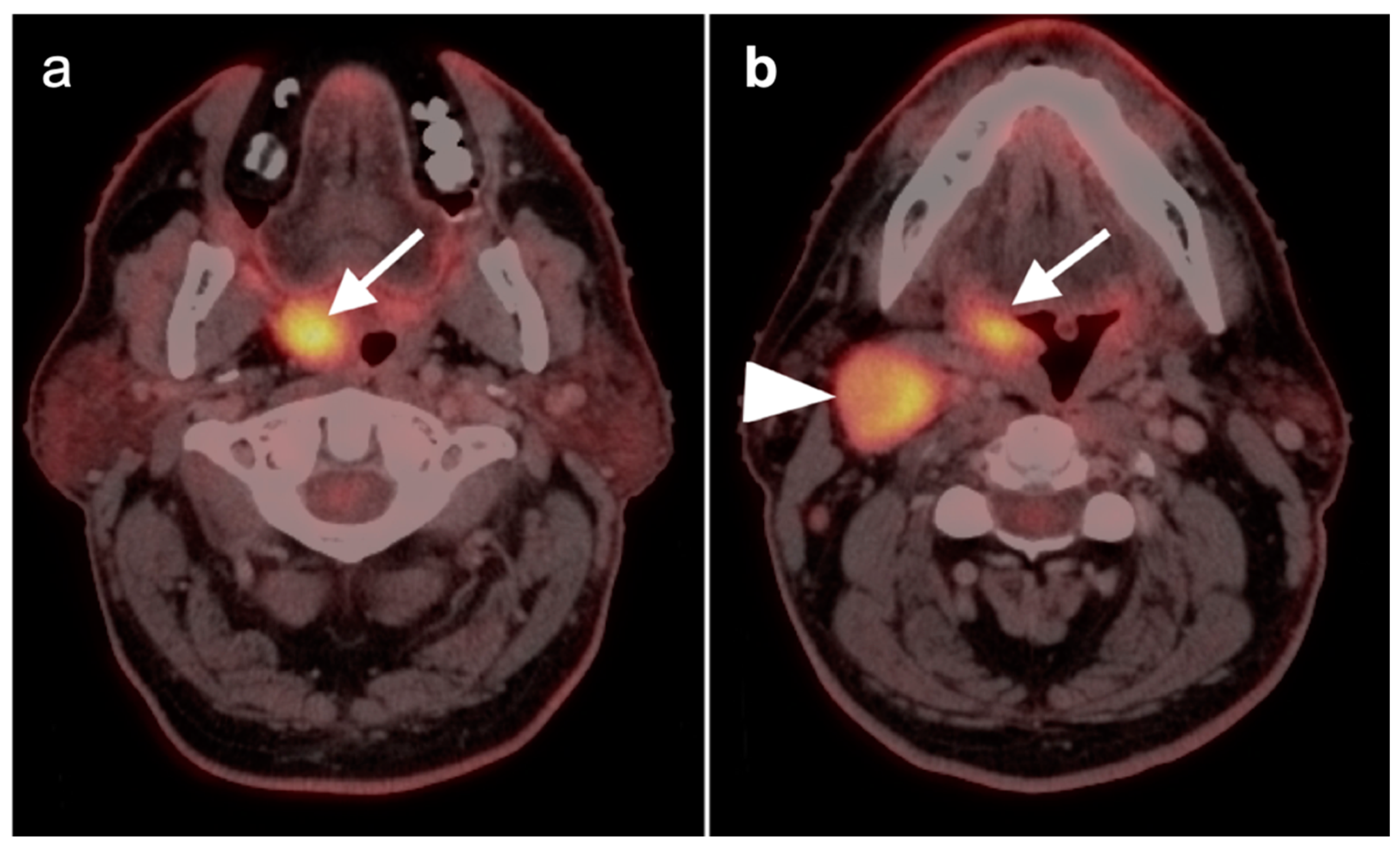Cancers 14 02726 g013