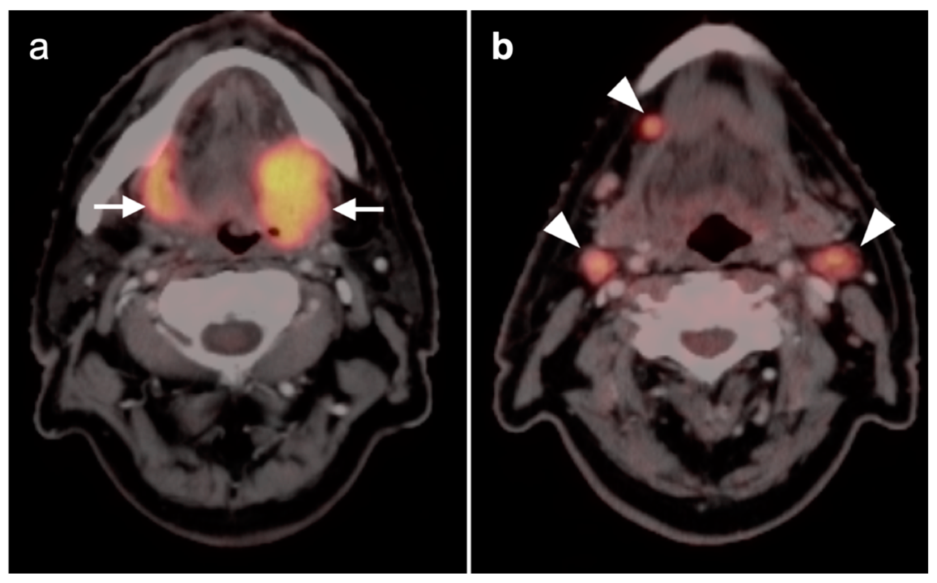 Cancers 14 02726 g014