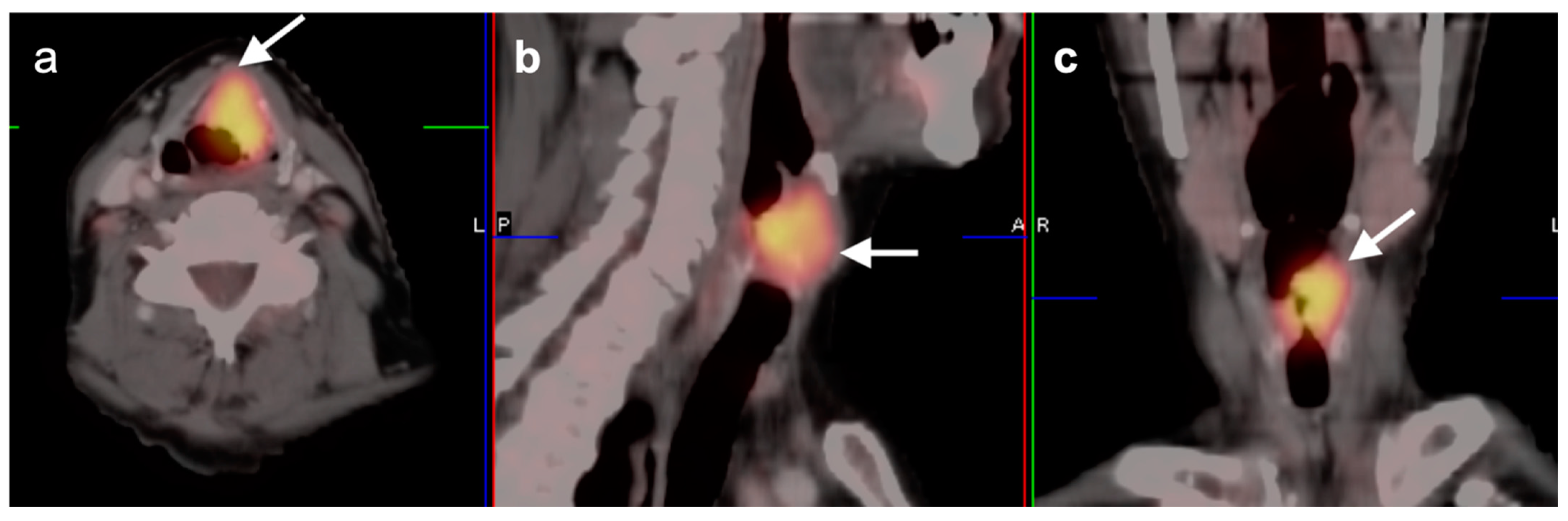 Cancers 14 02726 g017