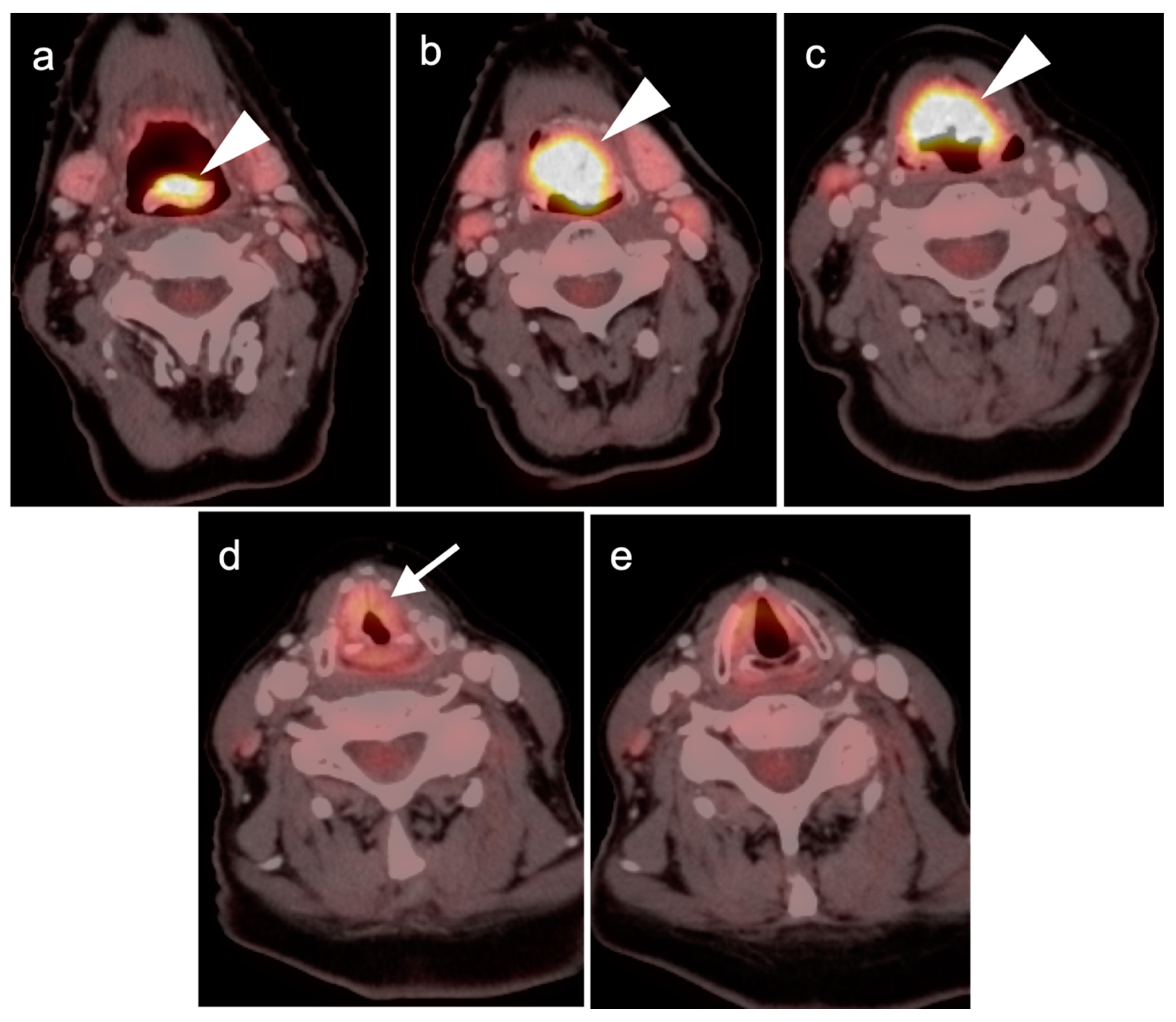 Cancers 14 02726 g018