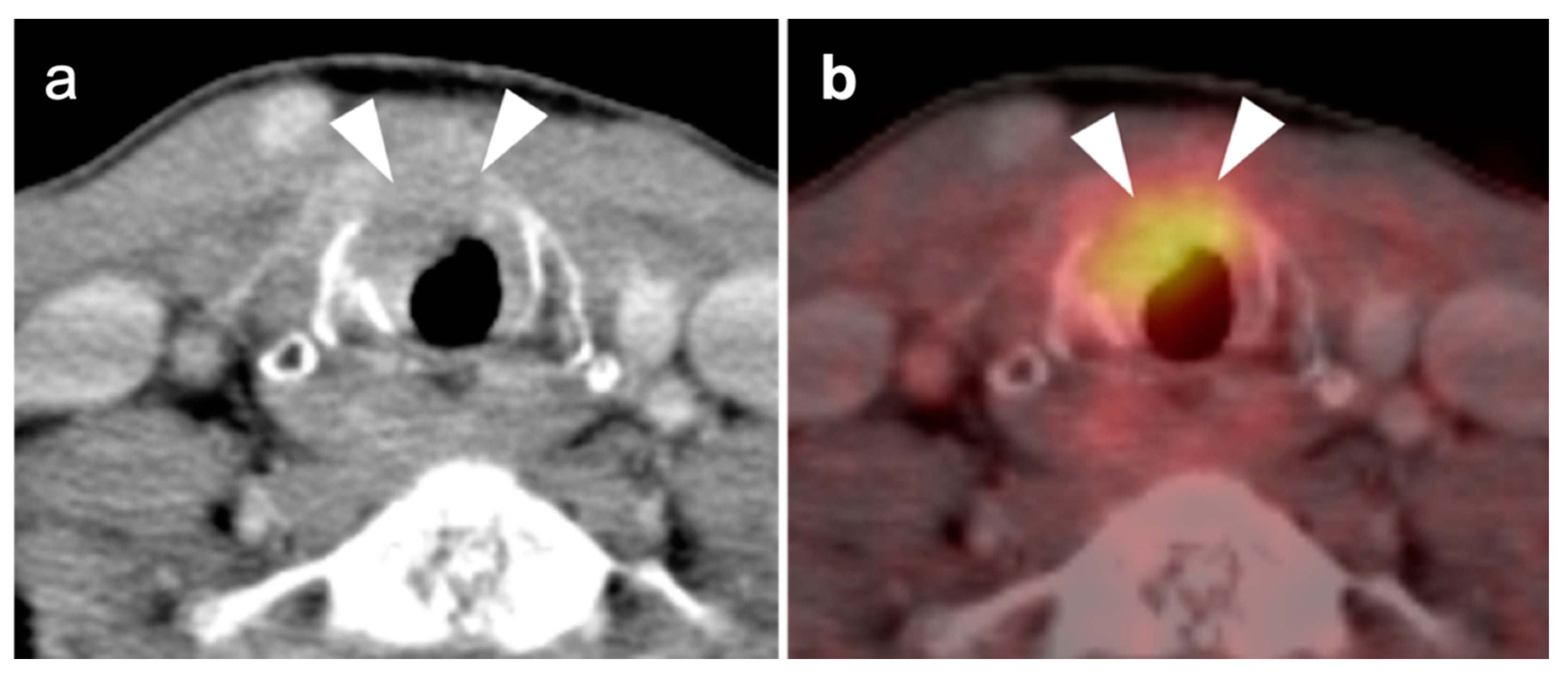 Cancers 14 02726 g020