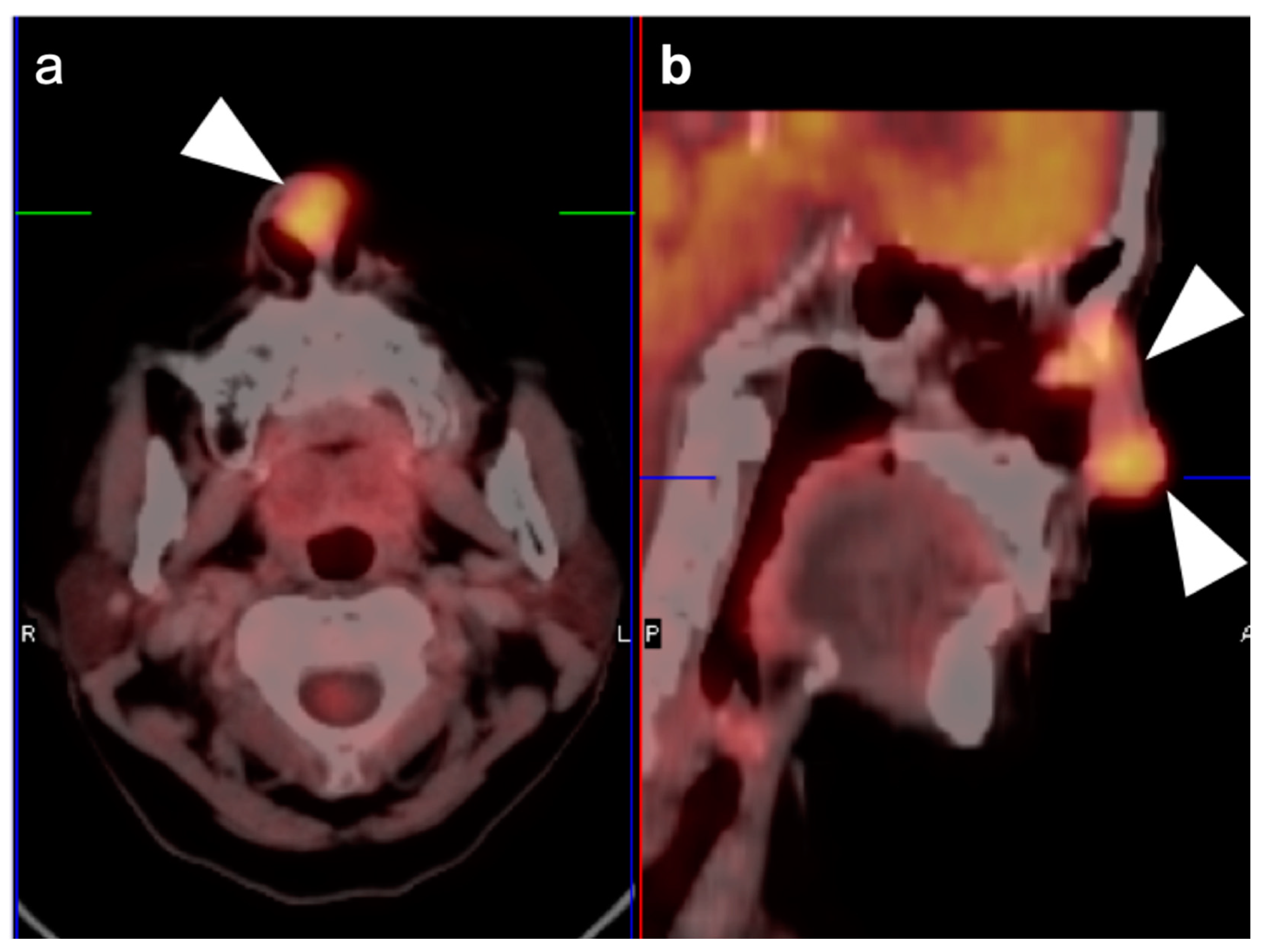 Cancers 14 02726 g021