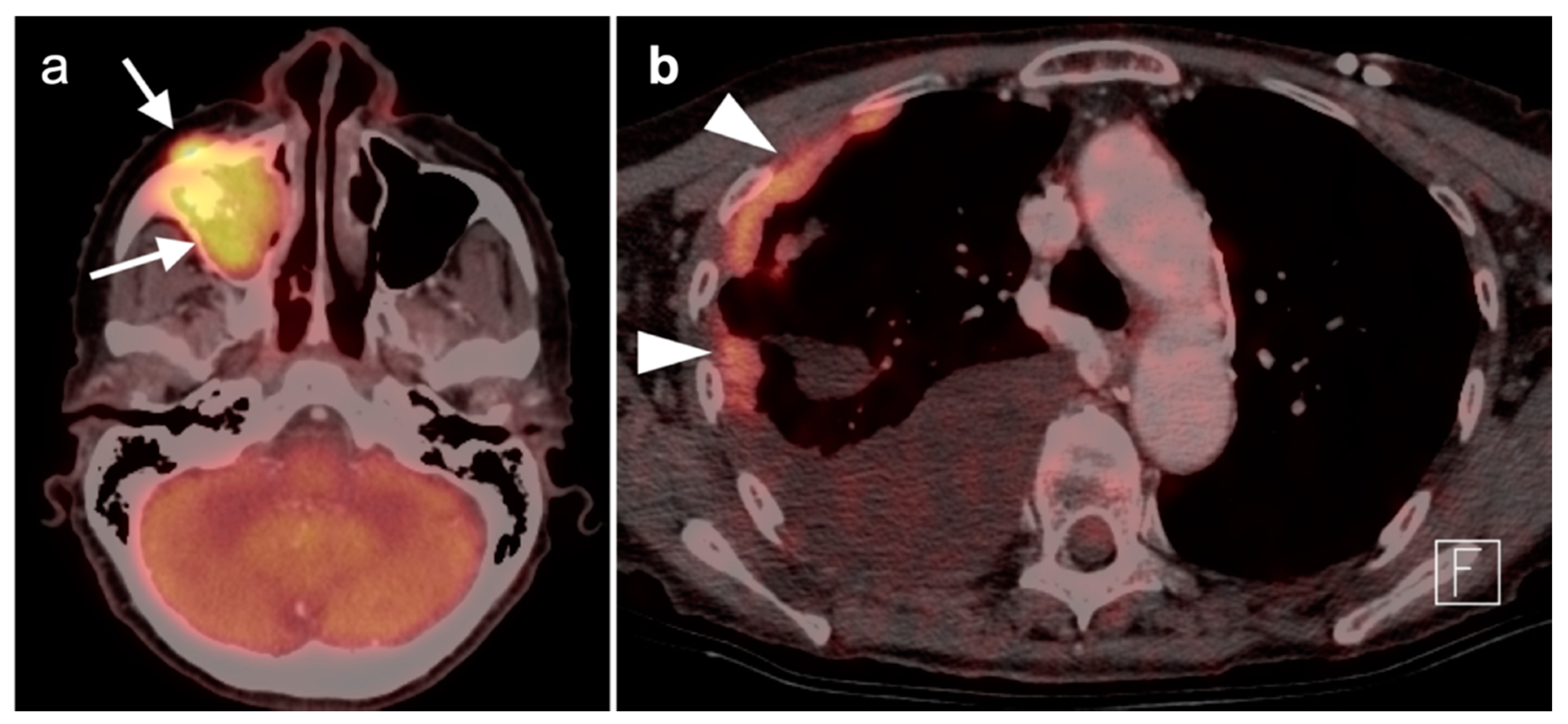 Cancers 14 02726 g022