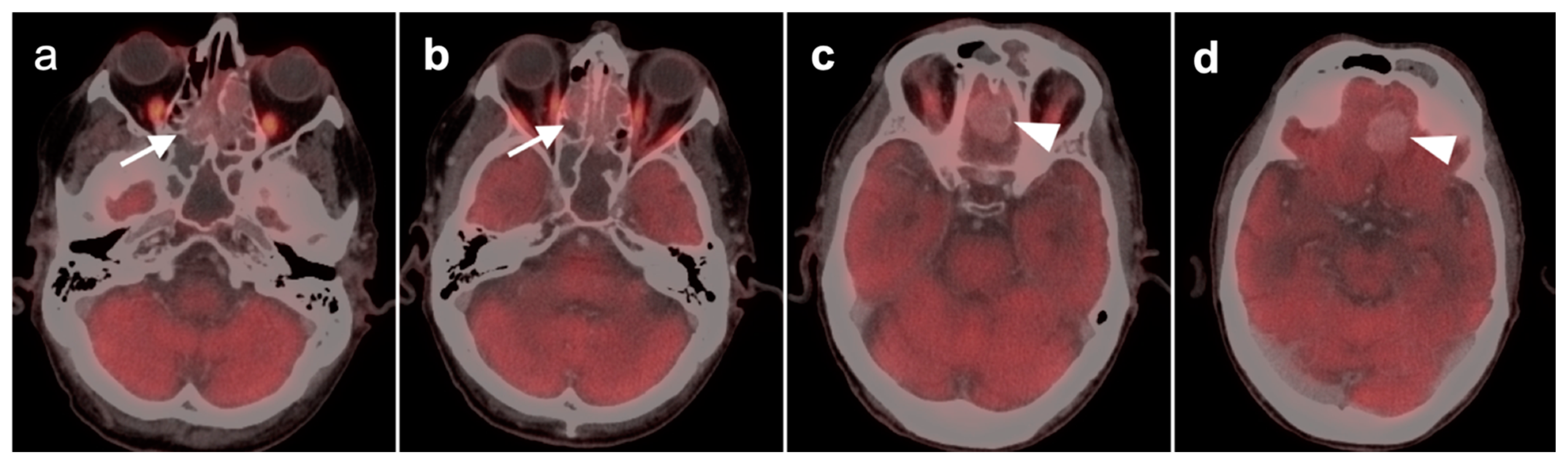 Cancers 14 02726 g023