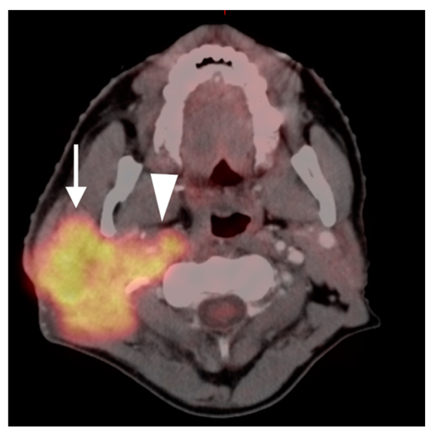 Cancers 14 02726 g024