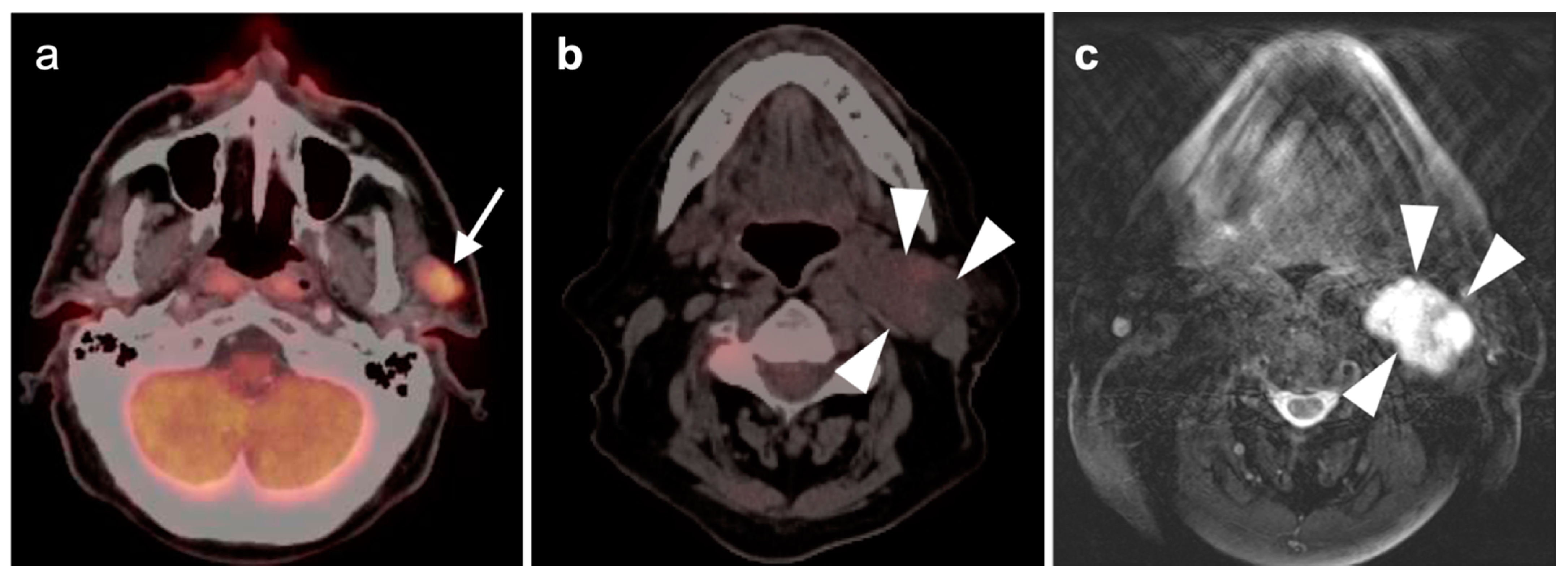 Cancers 14 02726 g025