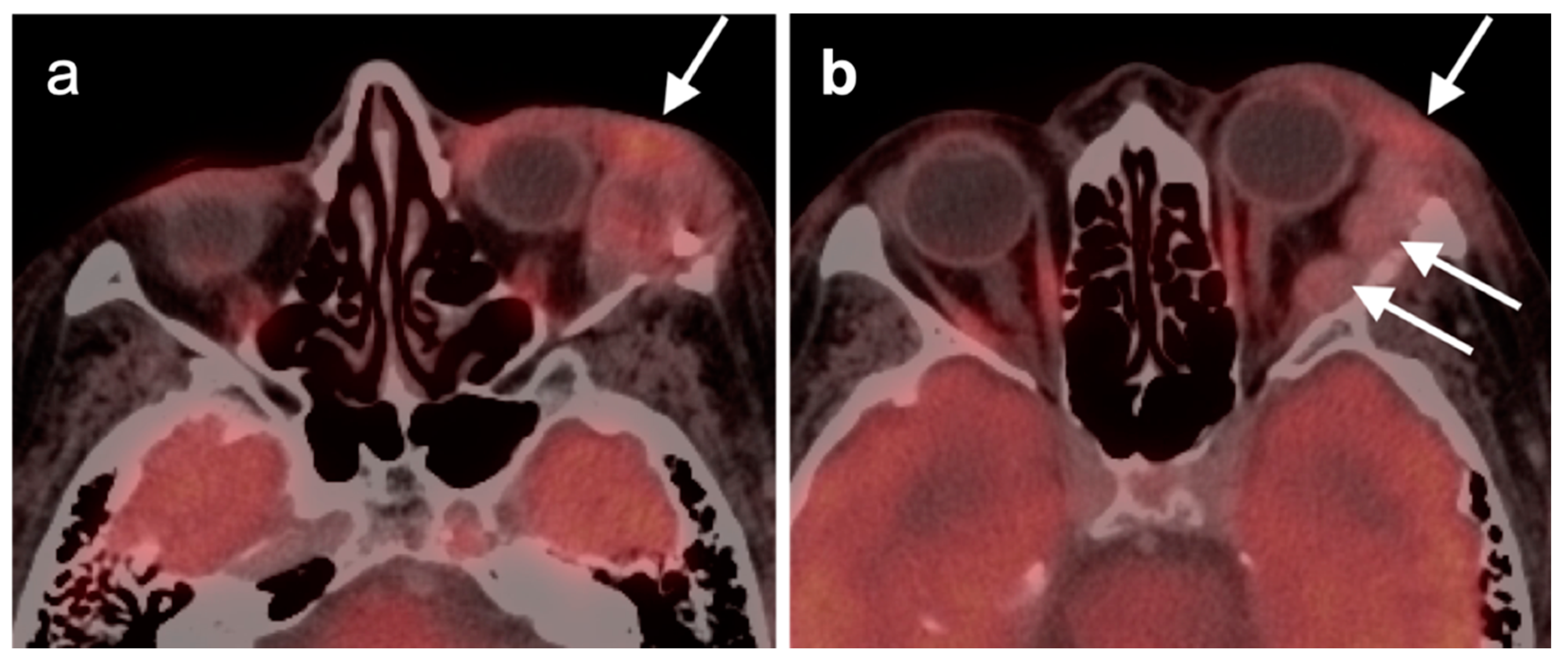 Cancers 14 02726 g026