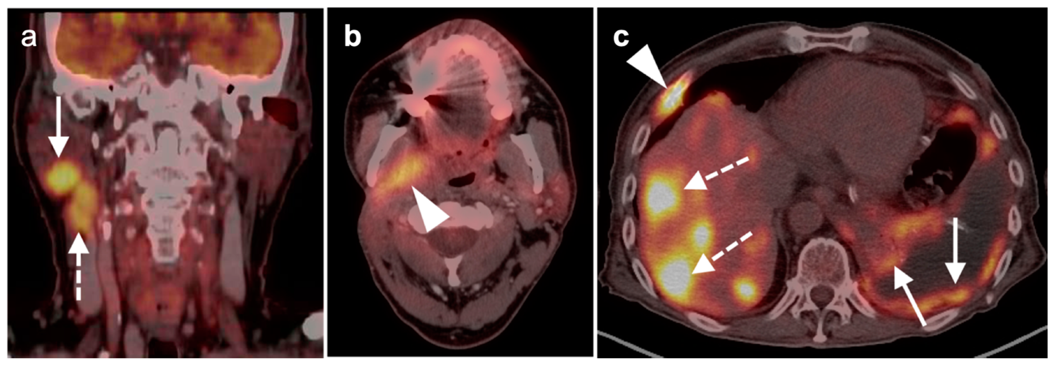 Cancers 14 02726 g028