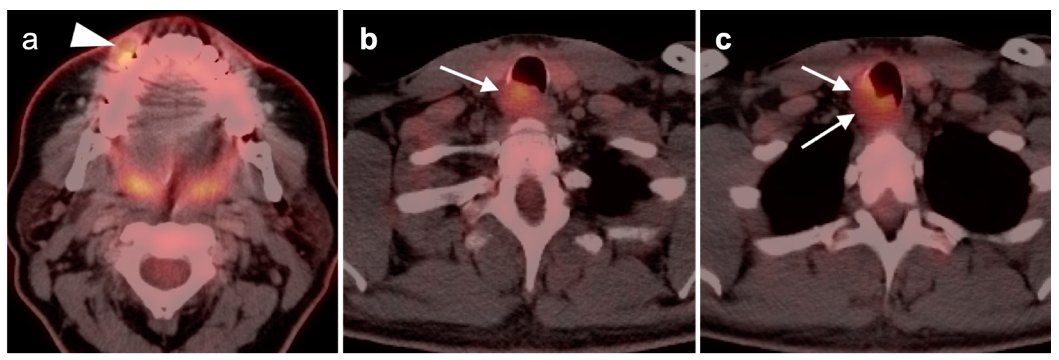 Cancers 14 02726 g029