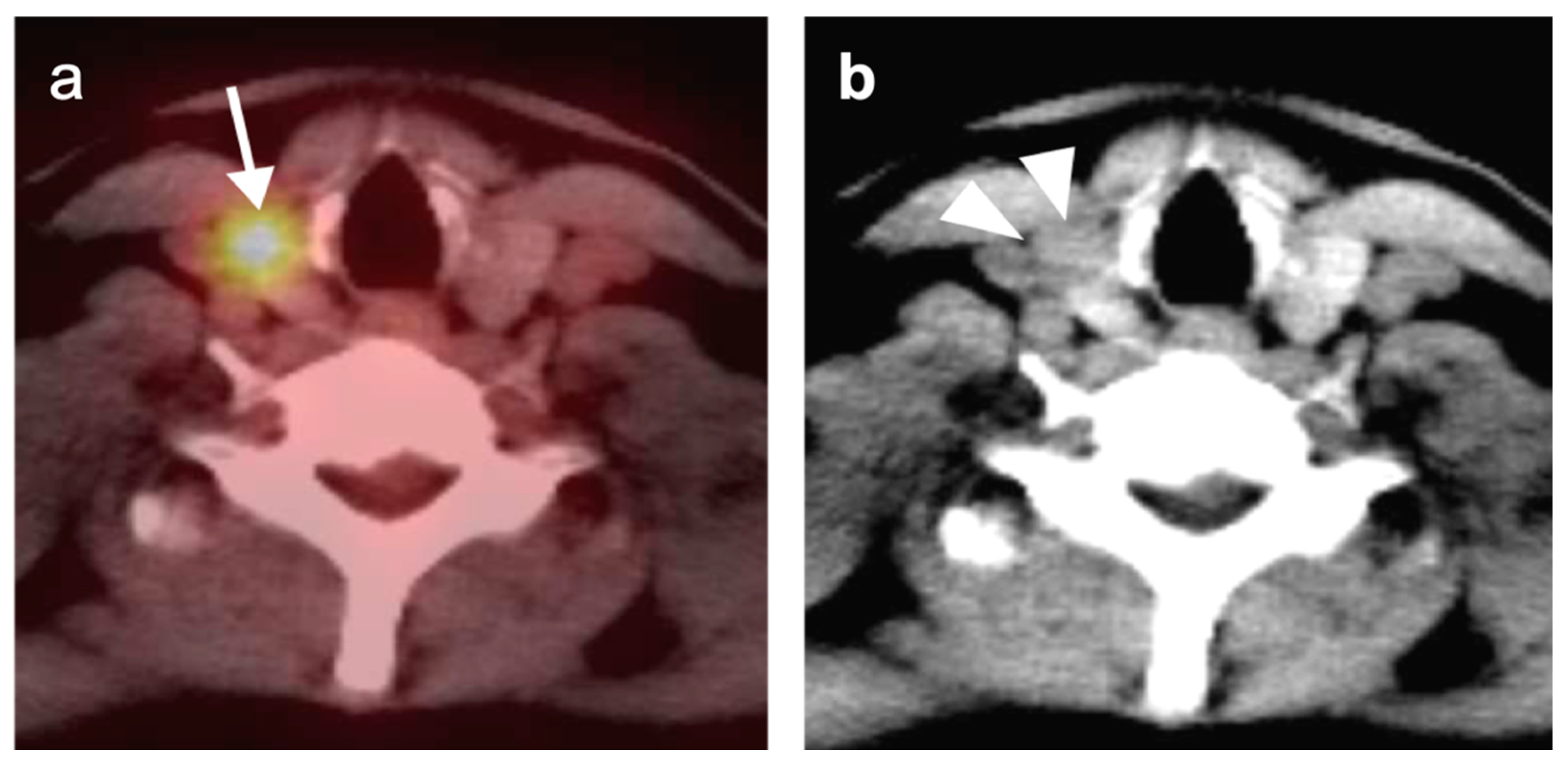 Cancers 14 02726 g030