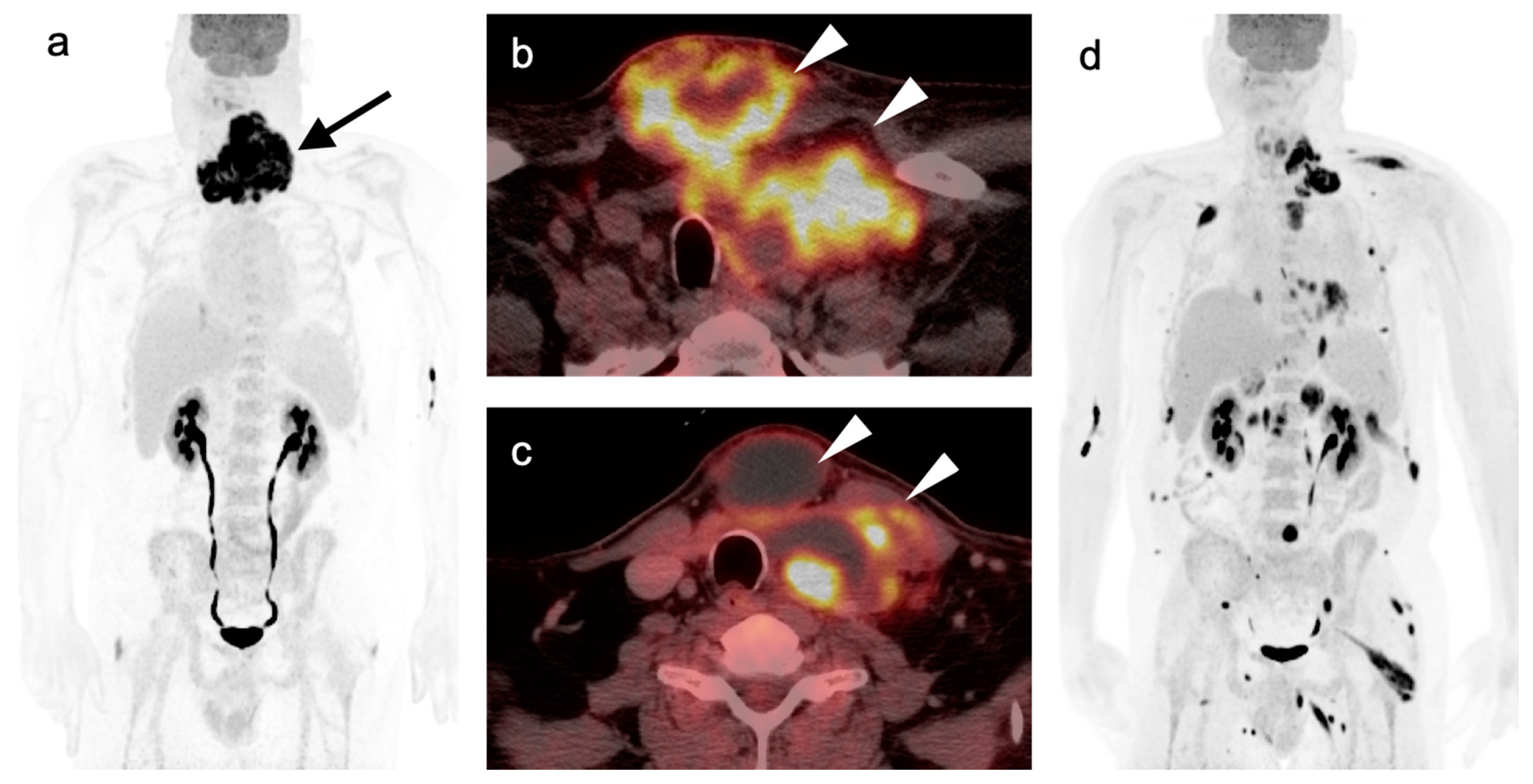 Cancers 14 02726 g032