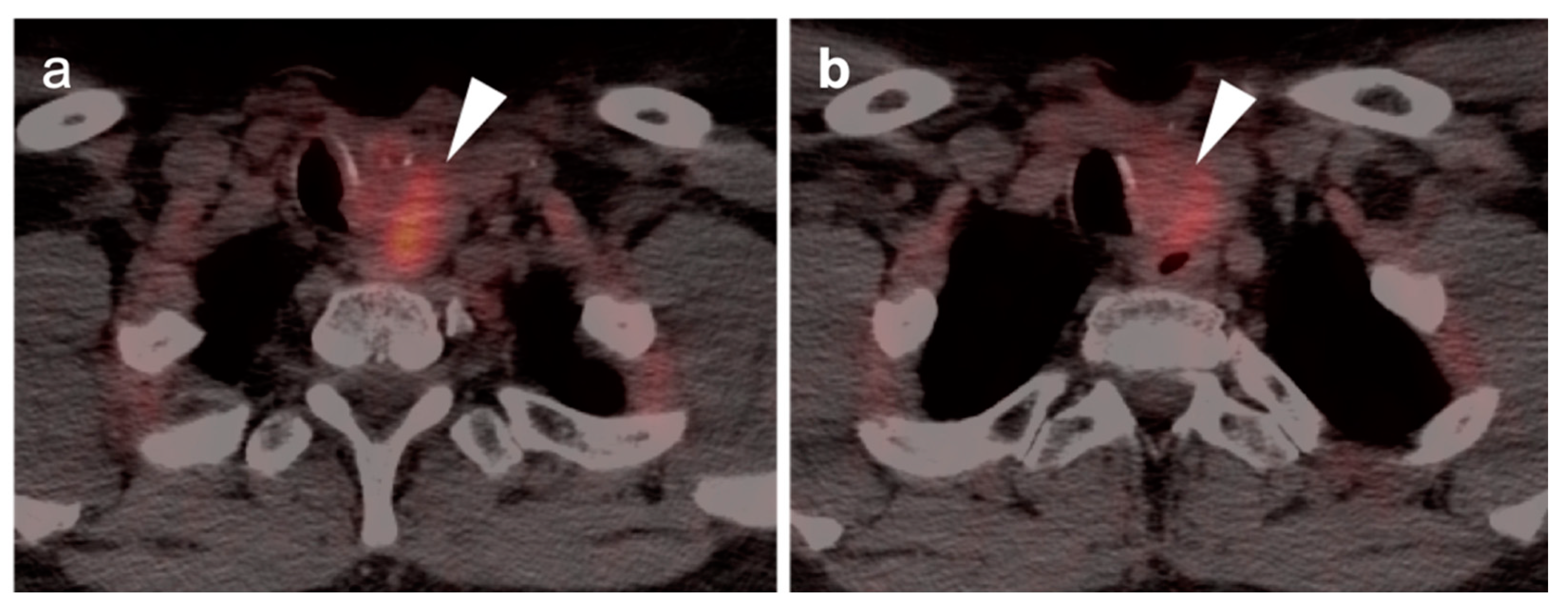 Cancers 14 02726 g033