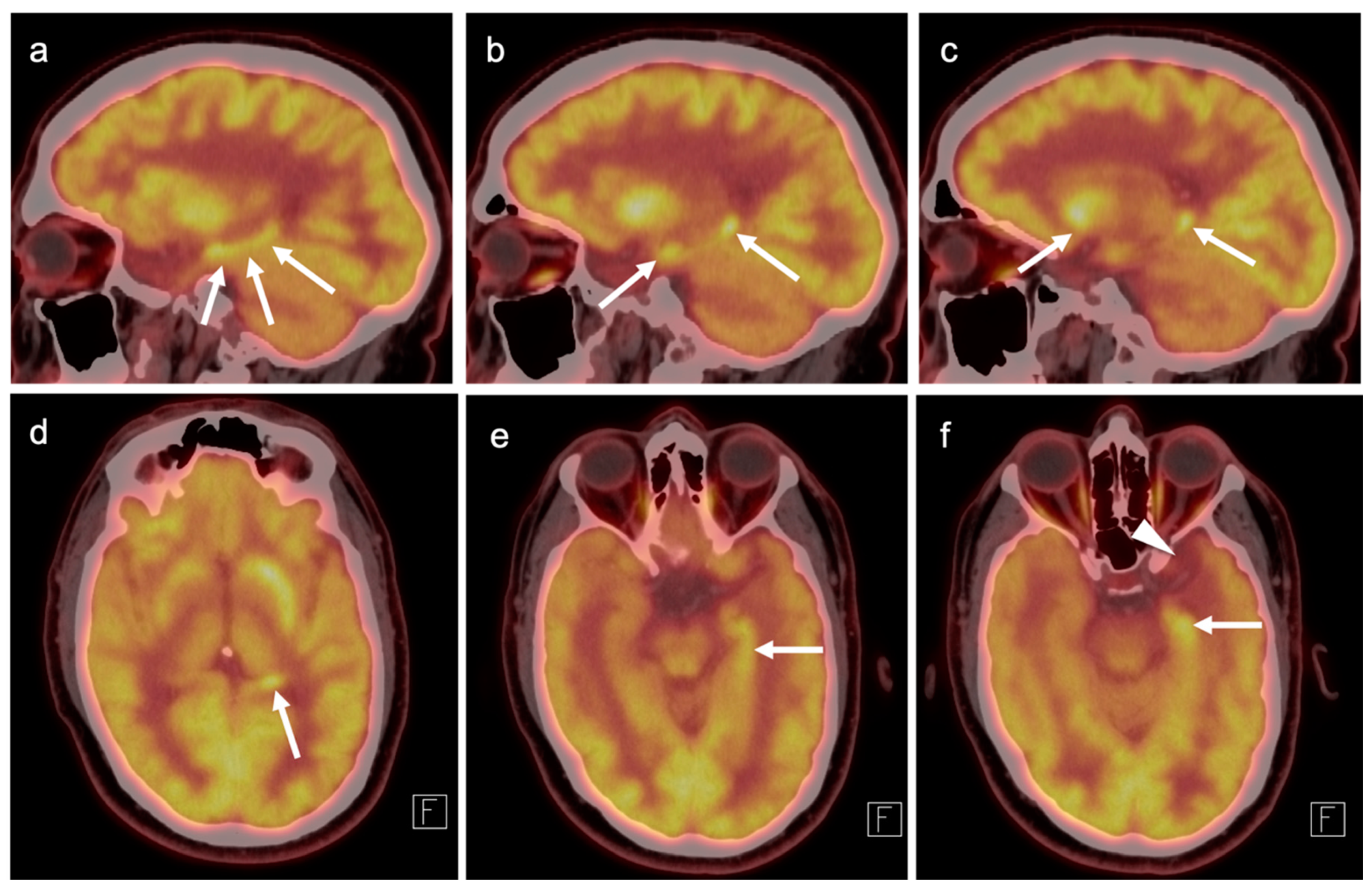 Cancers 14 02726 g034