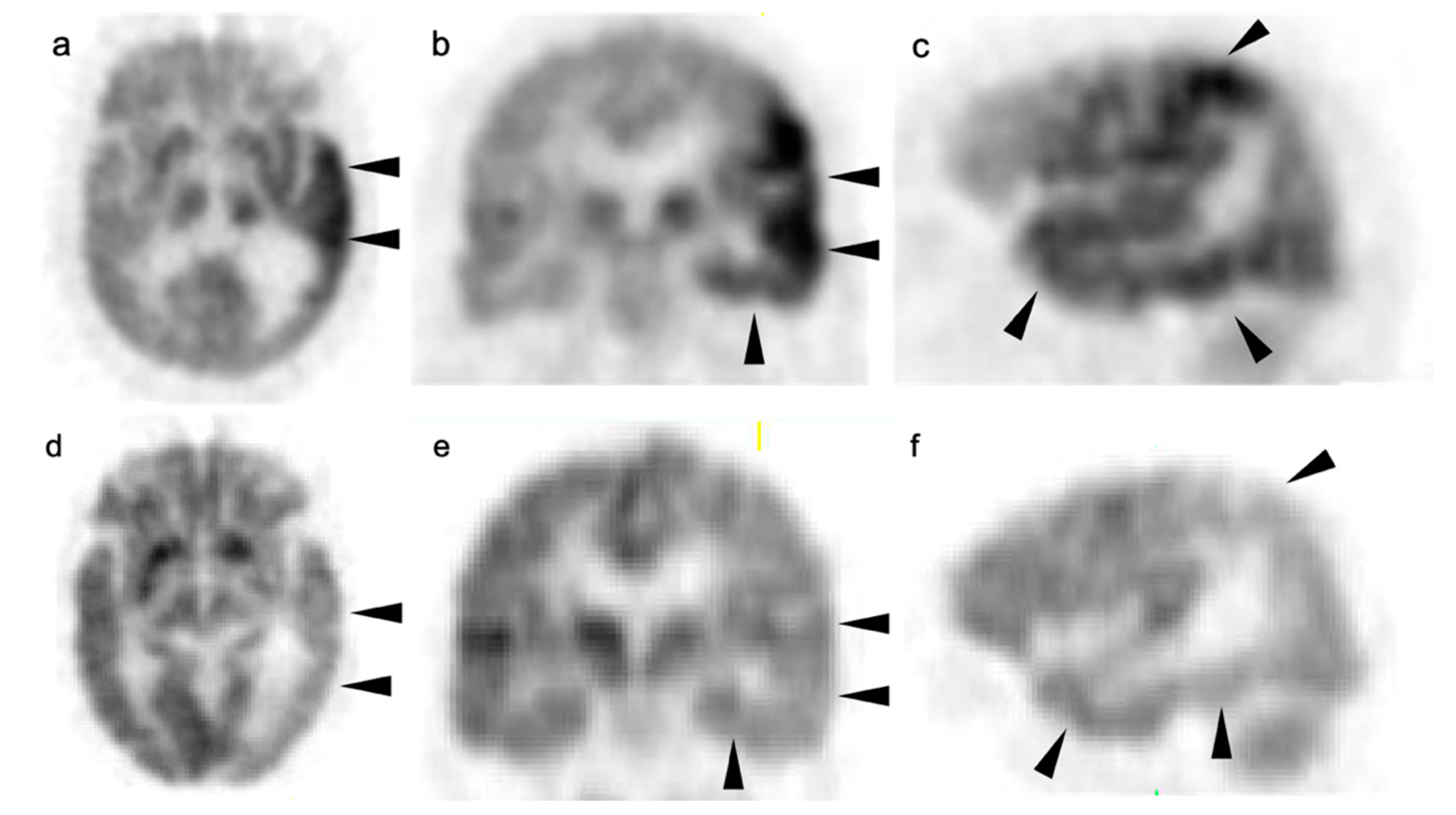 Cancers 14 02726 g036