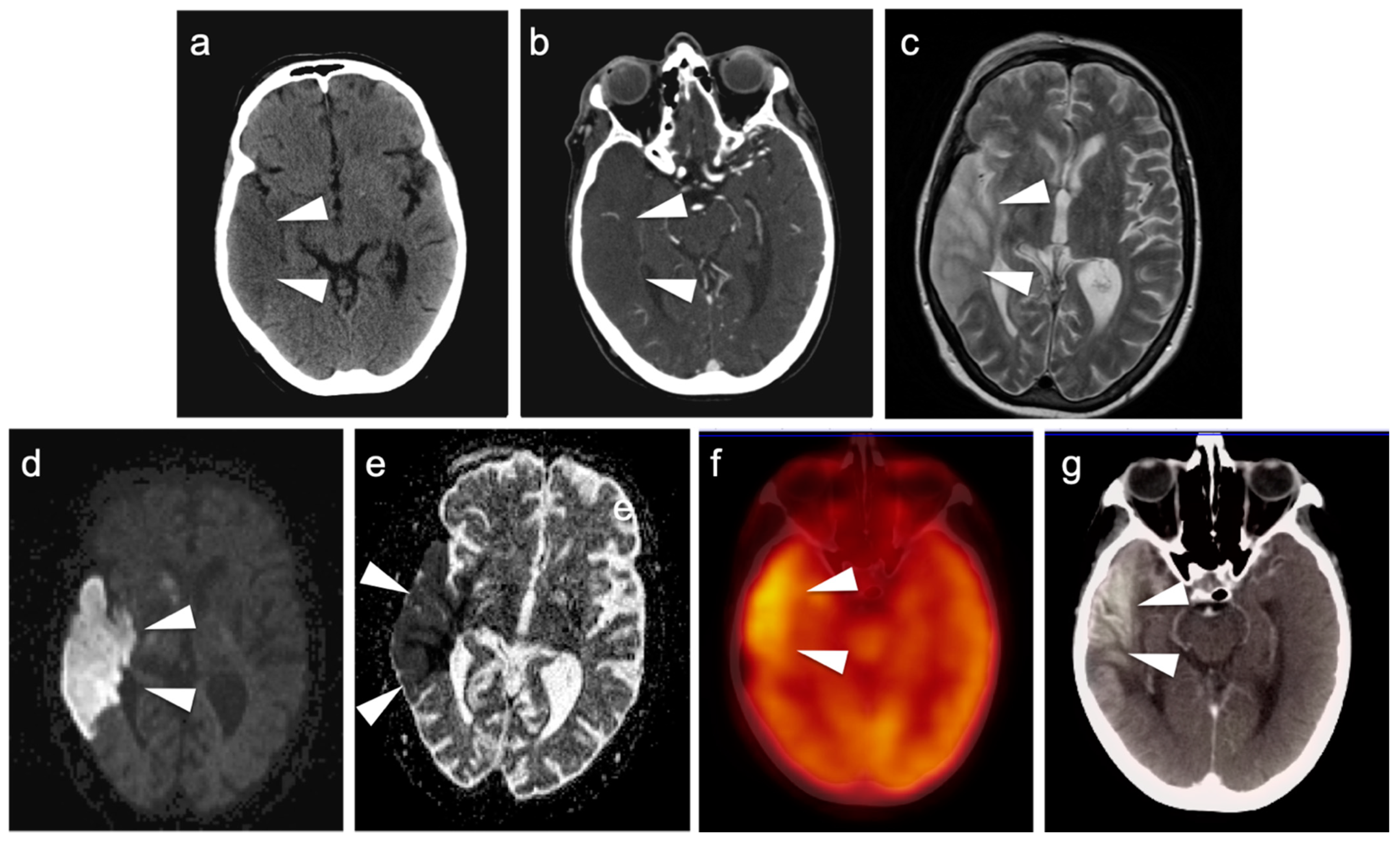 Cancers 14 02726 g037