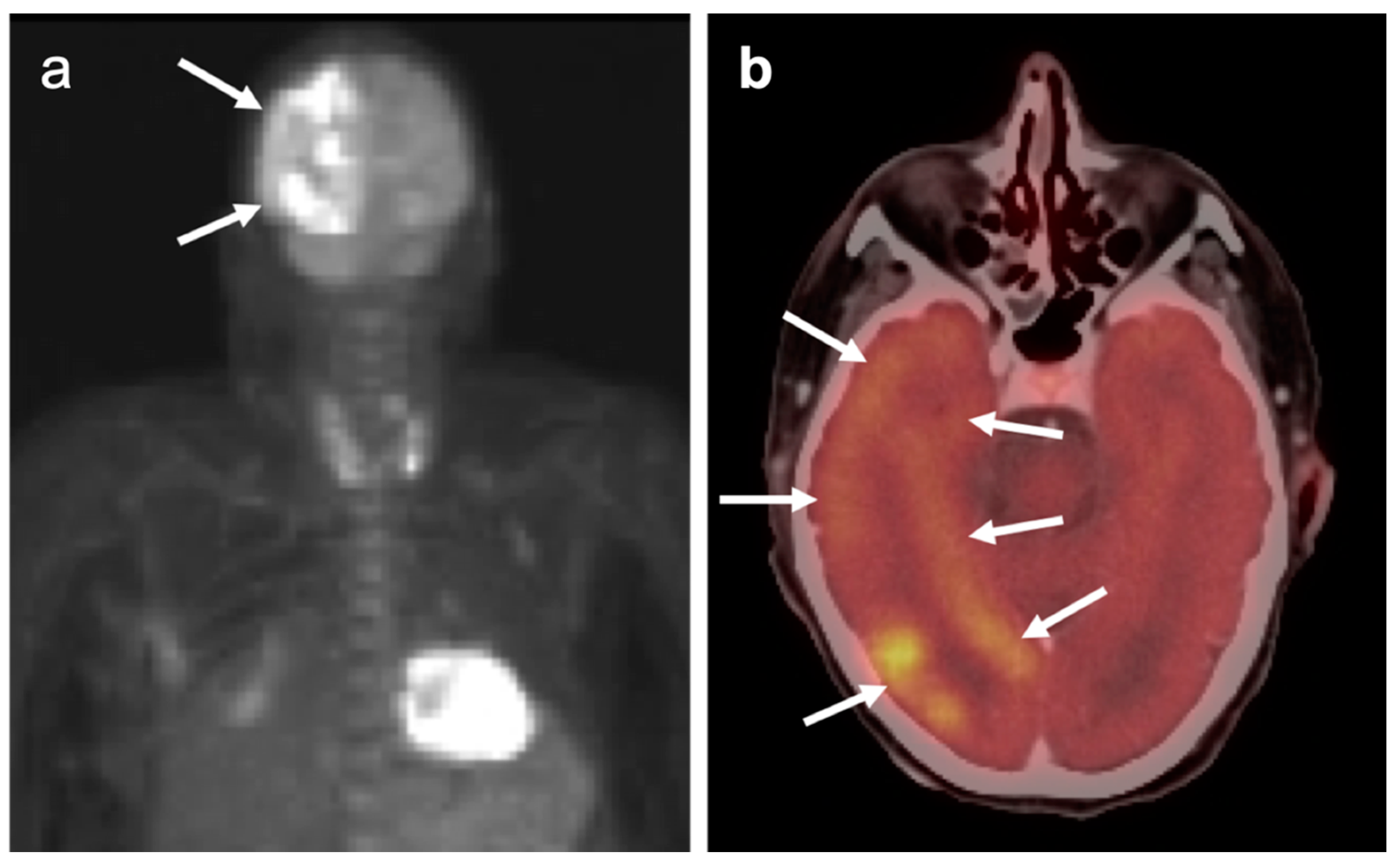 Cancers 14 02726 g038