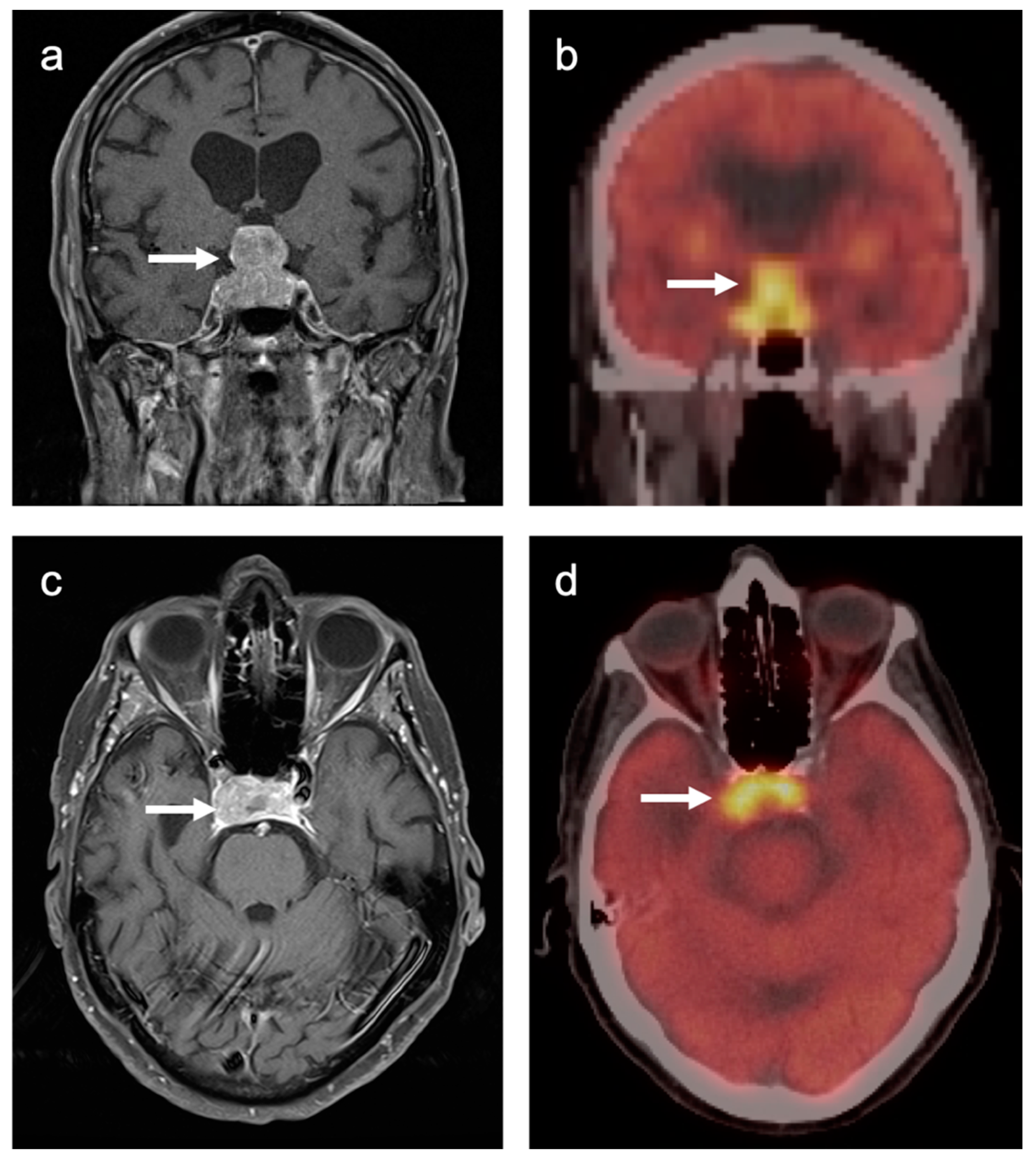 Cancers 14 02726 g039