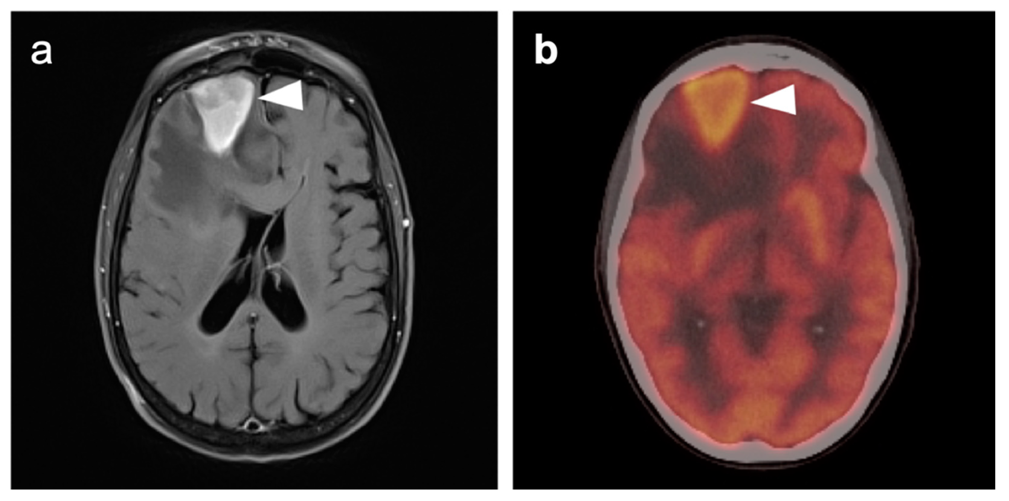 Cancers 14 02726 g042