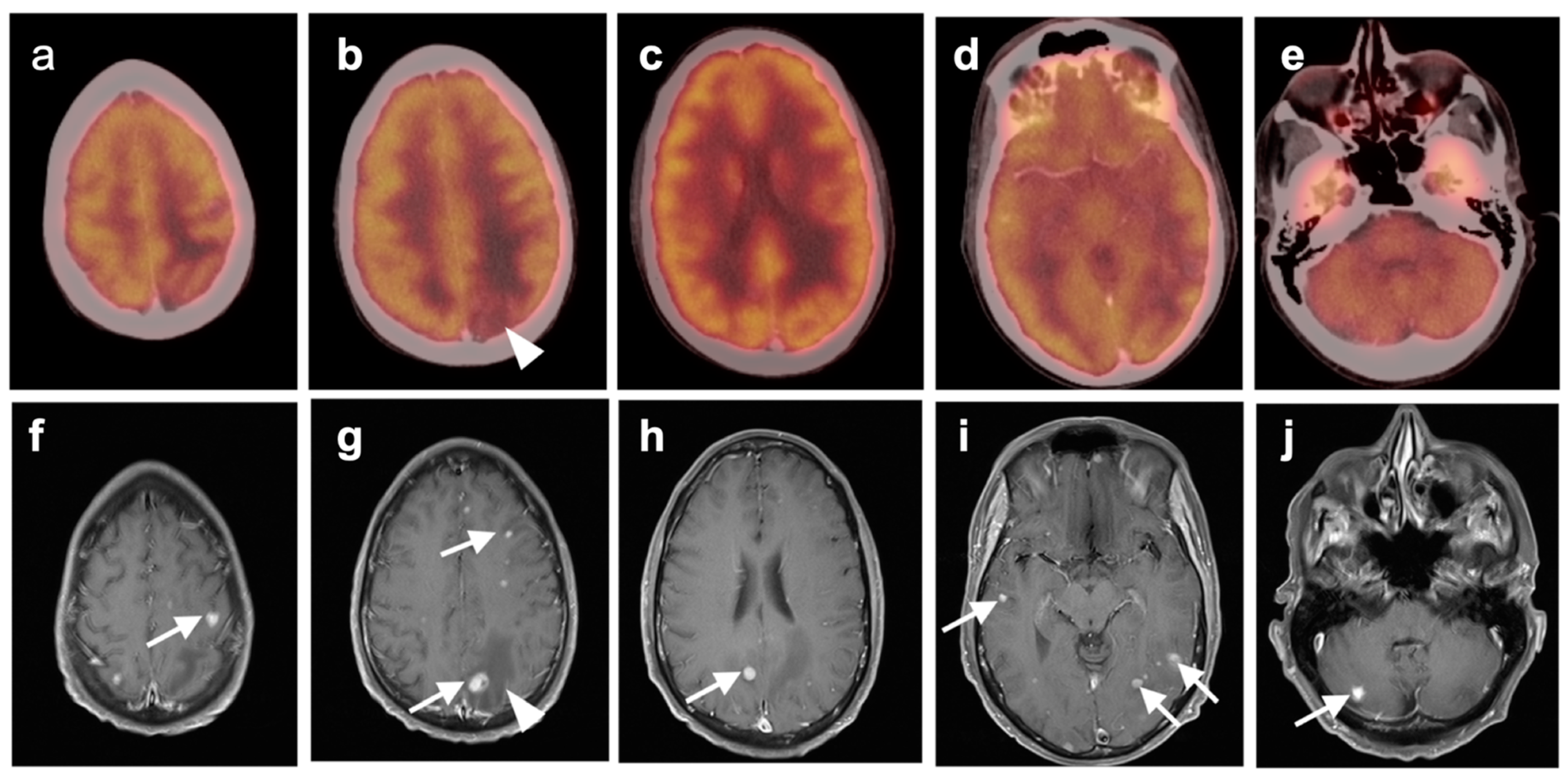 Cancers 14 02726 g043