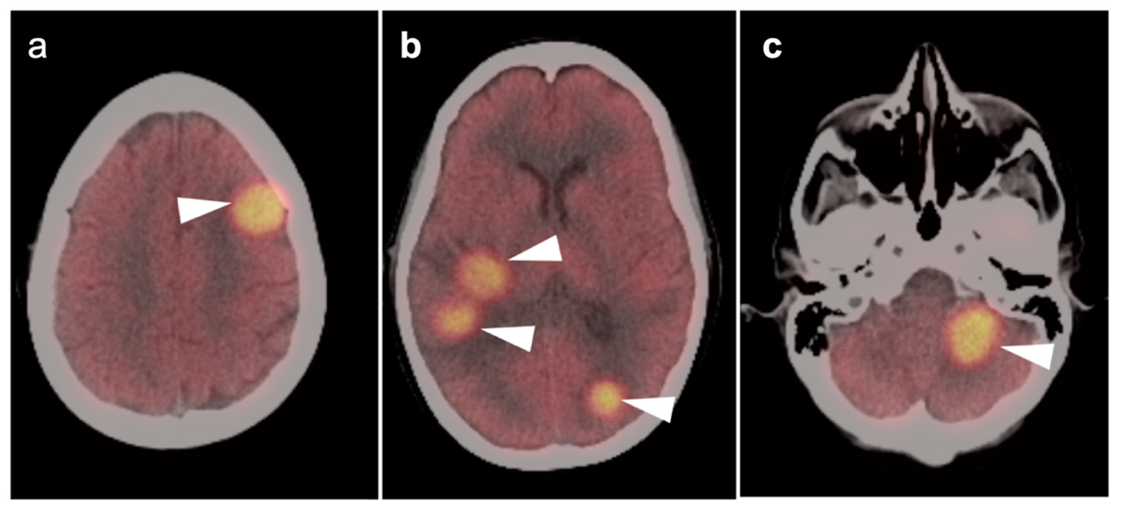 Cancers 14 02726 g044