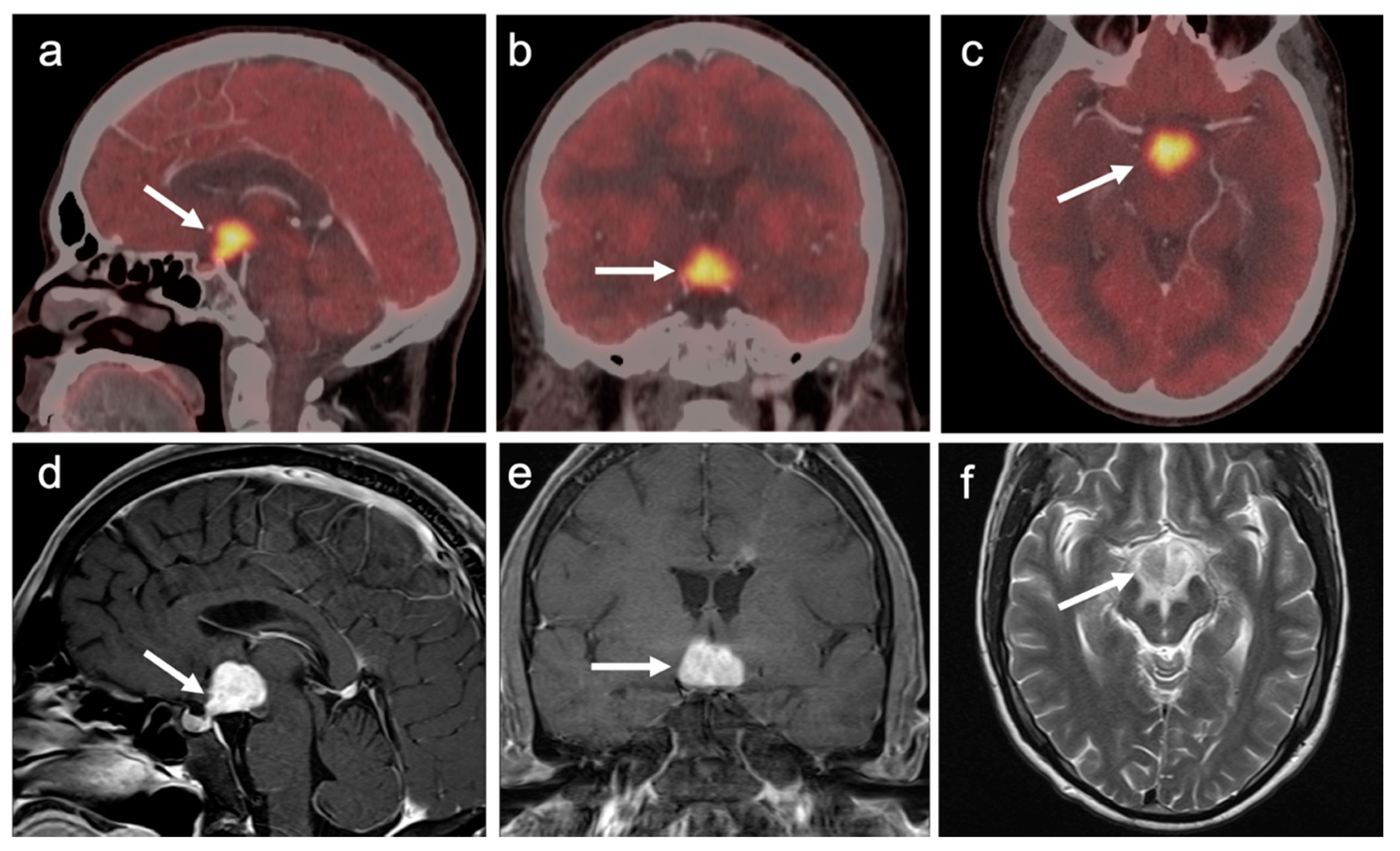 Cancers 14 02726 g045