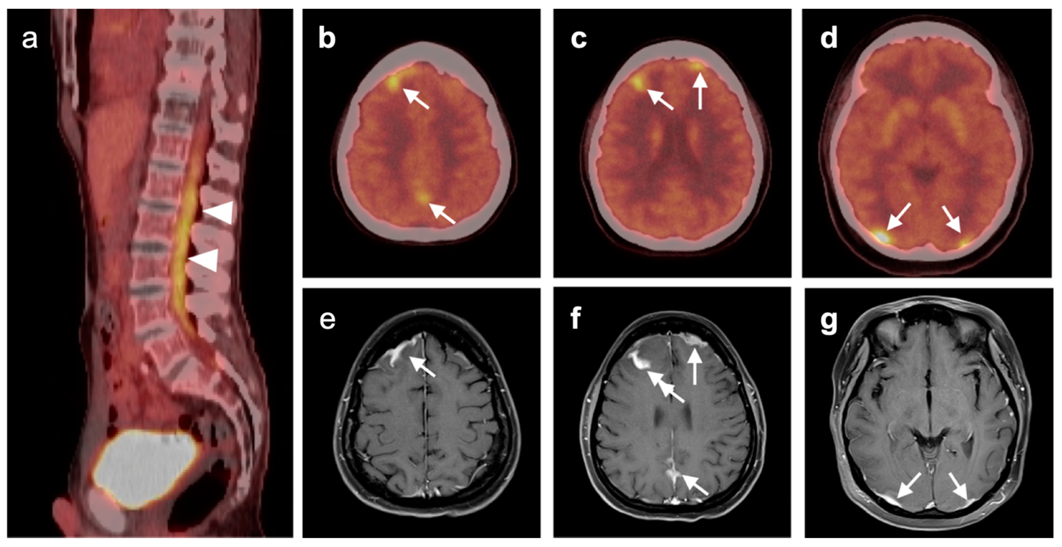 Cancers 14 02726 g046