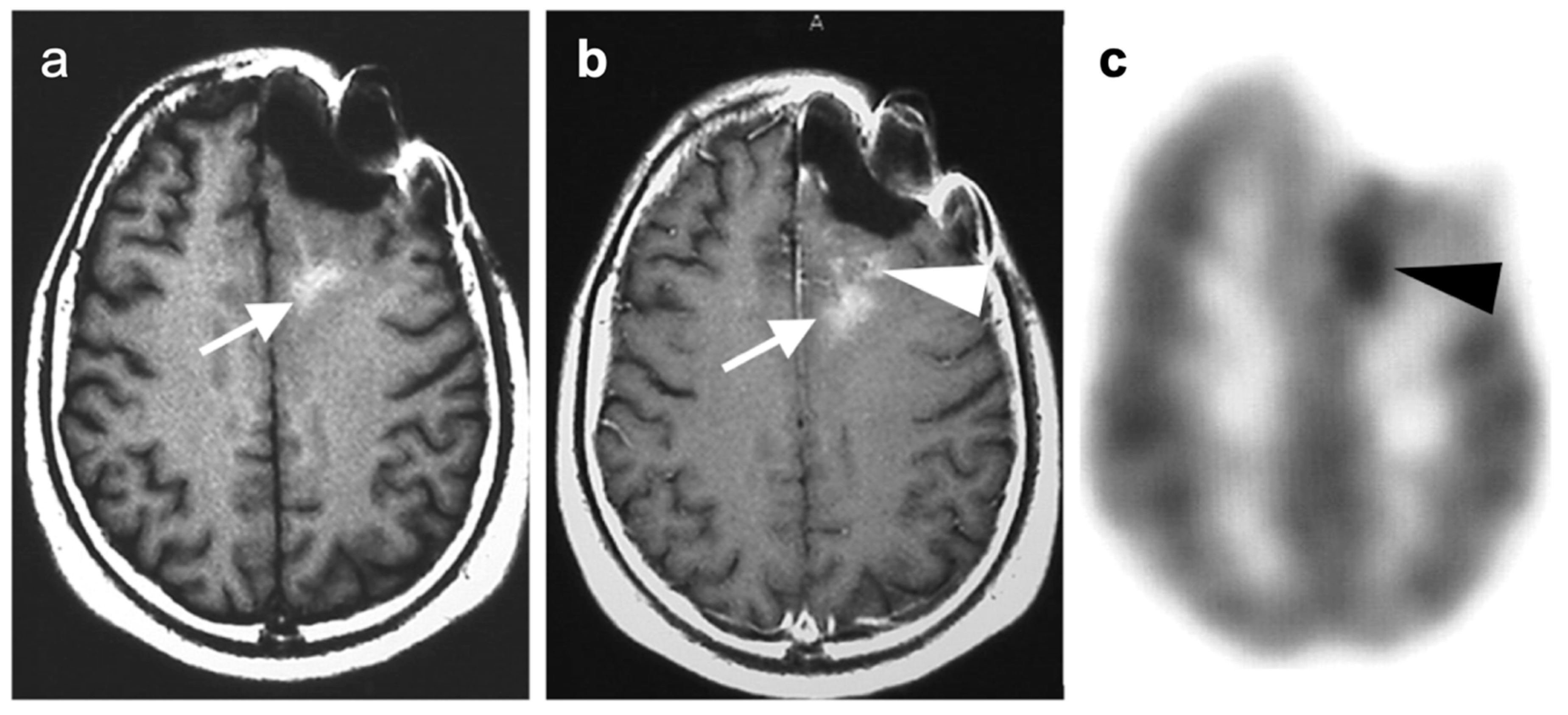 Cancers 14 02726 g047