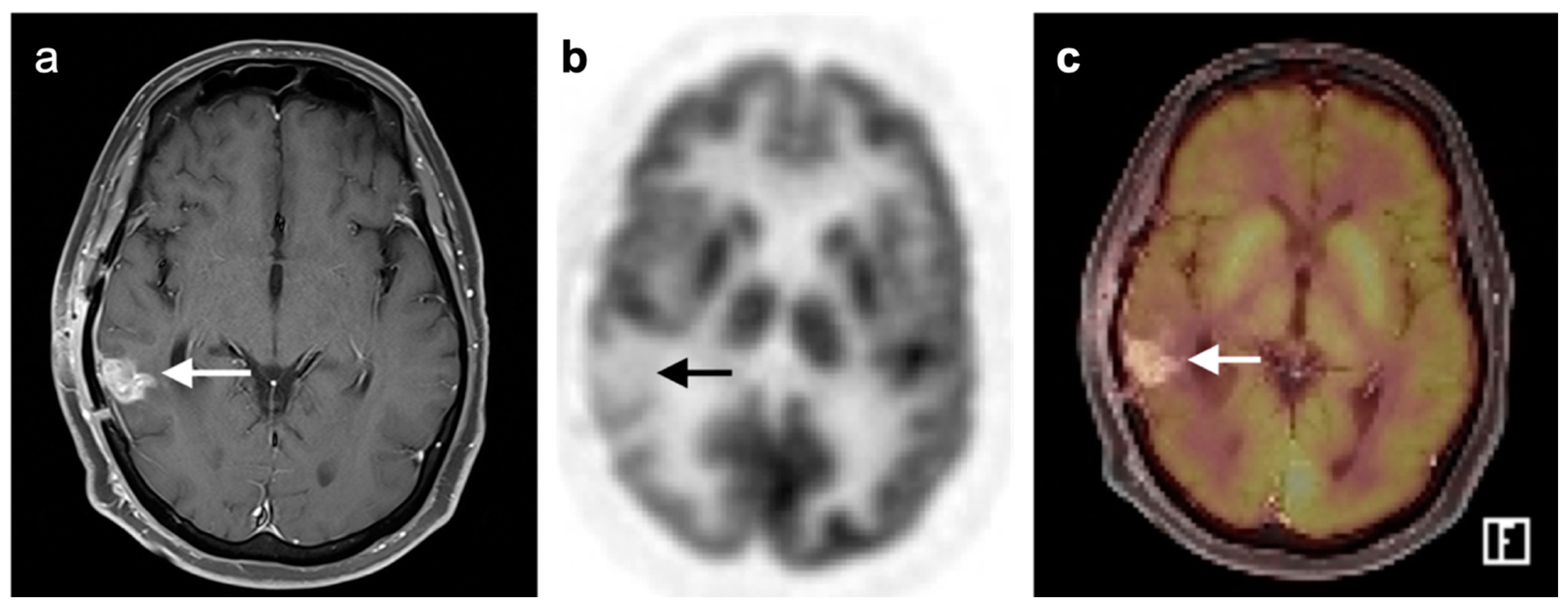 Cancers 14 02726 g048