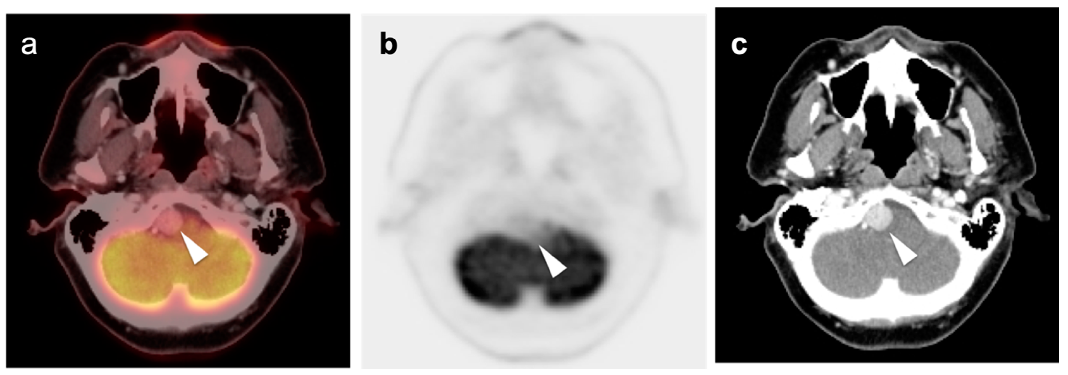 Cancers 14 02726 g049
