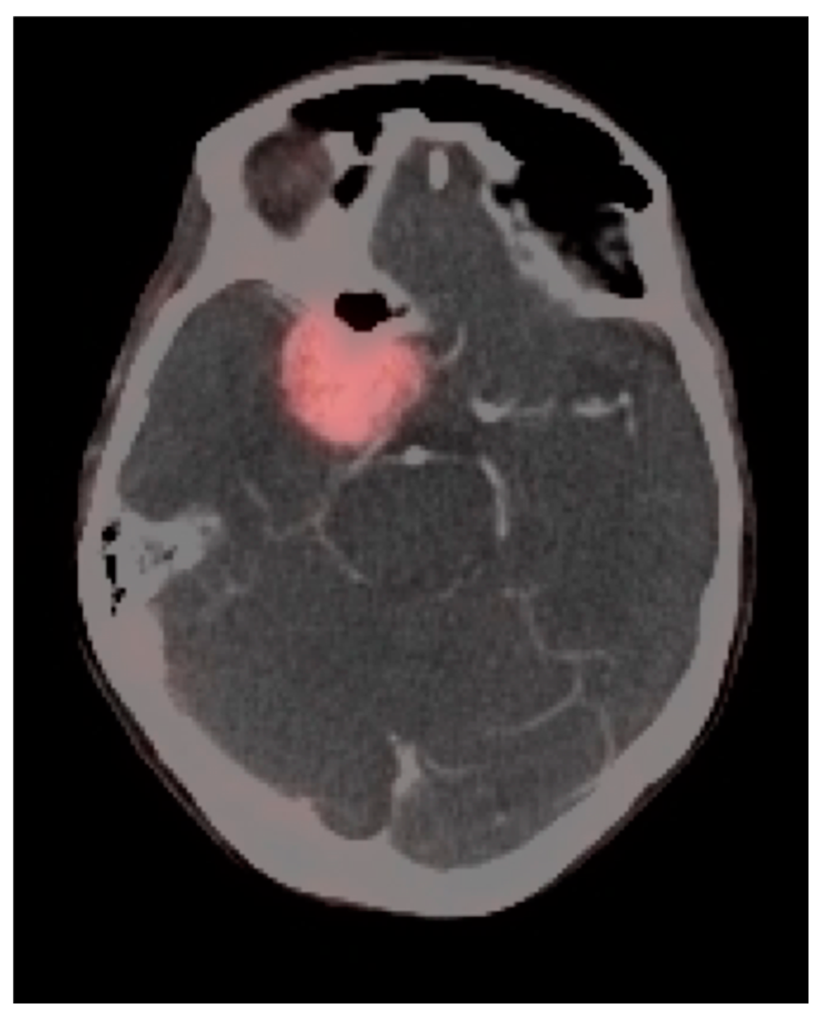 Cancers 14 02726 g050