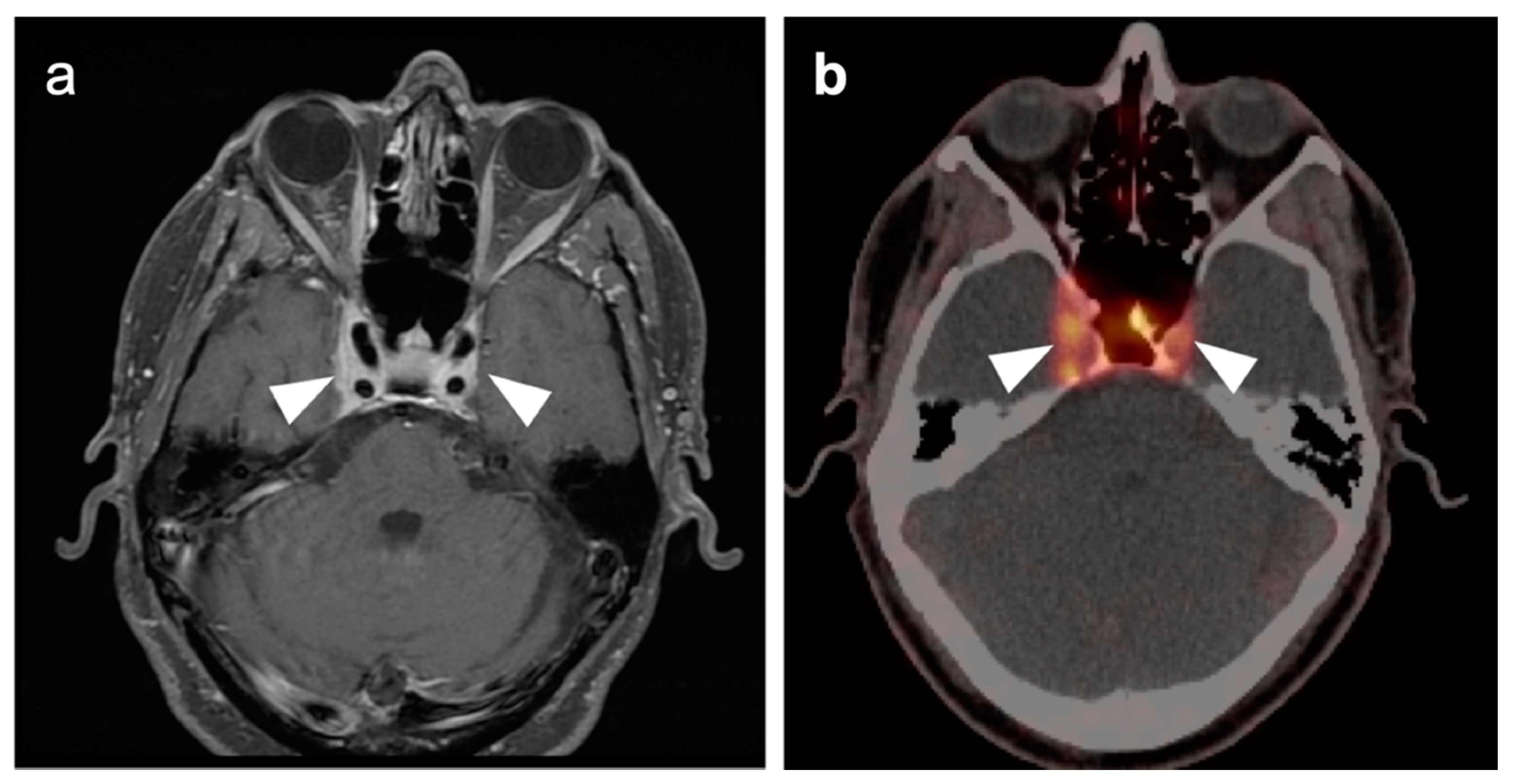 Cancers 14 02726 g051