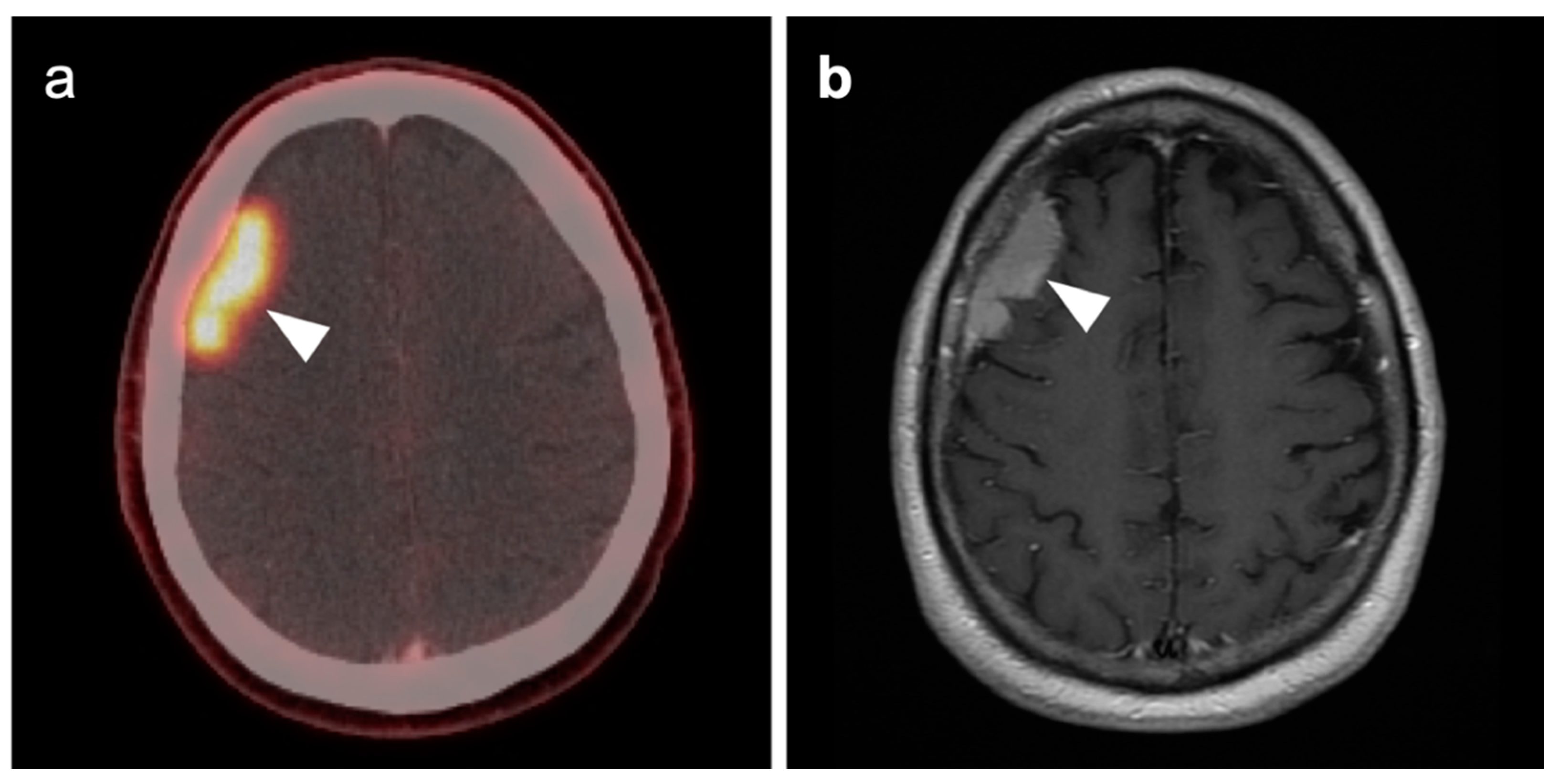 Cancers 14 02726 g052