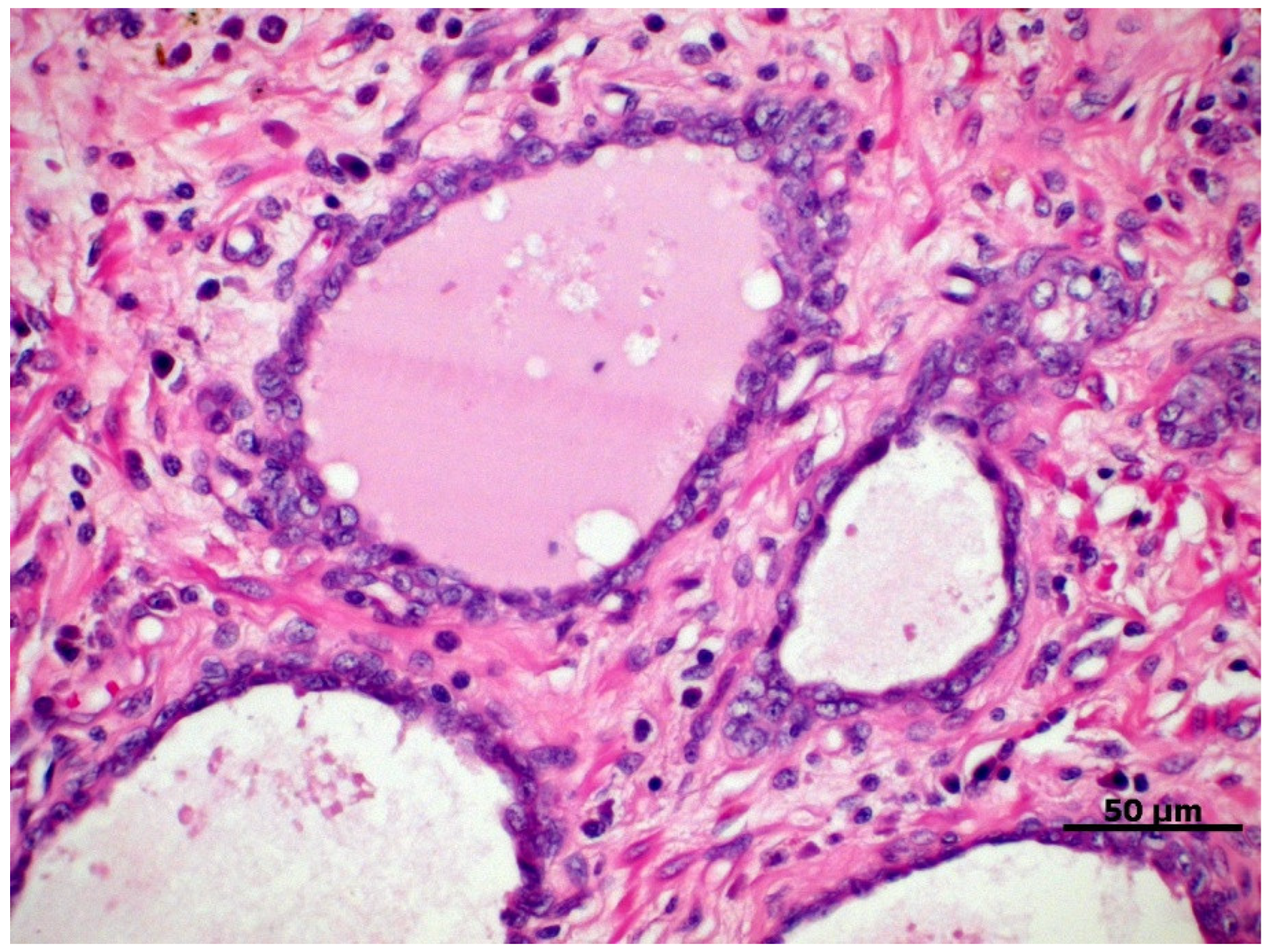 Cancers 14 02727 g001 Cancers 14 02727 g001