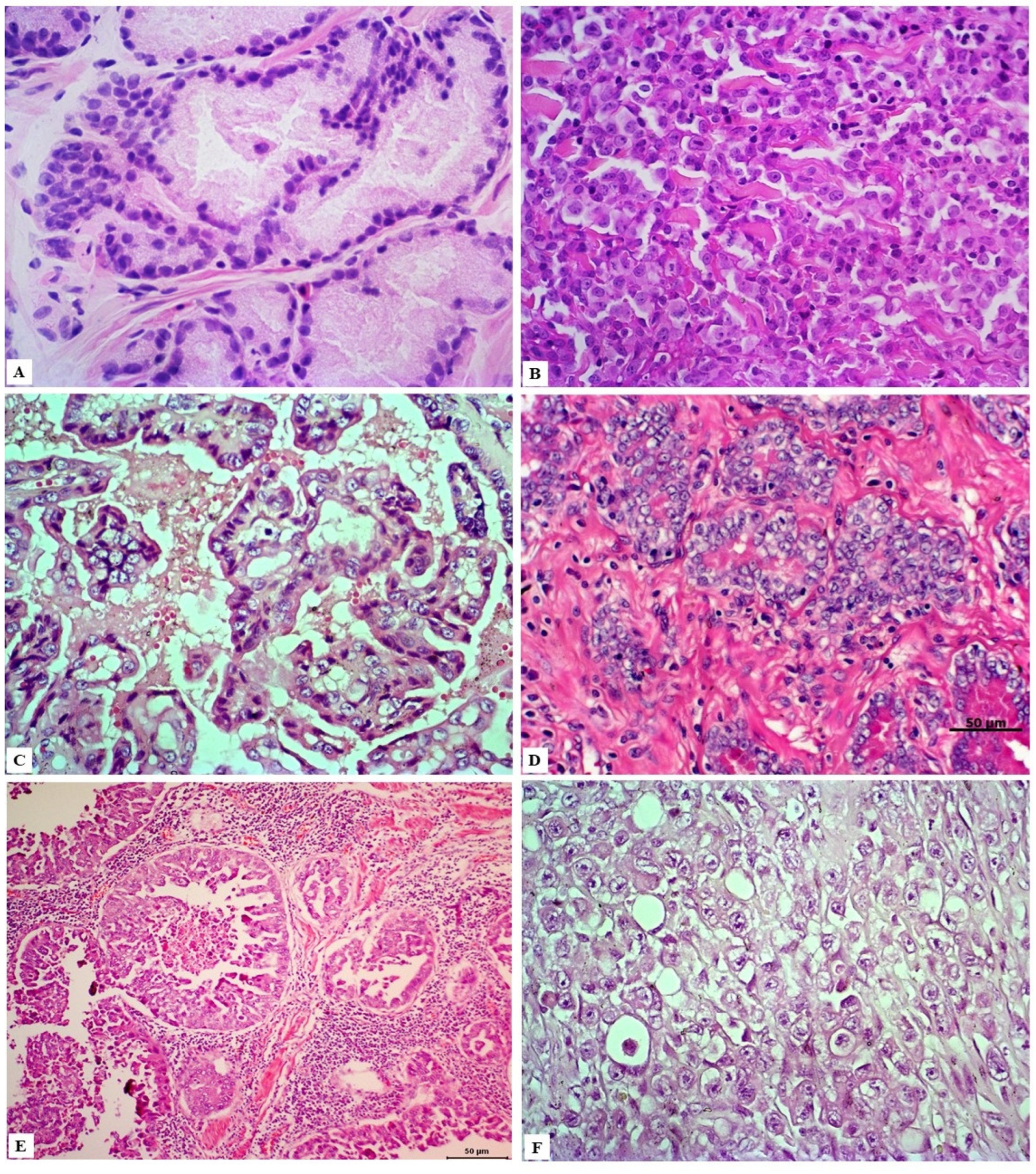 Cancers 14 02727 g002 Cancers 14 02727 g002