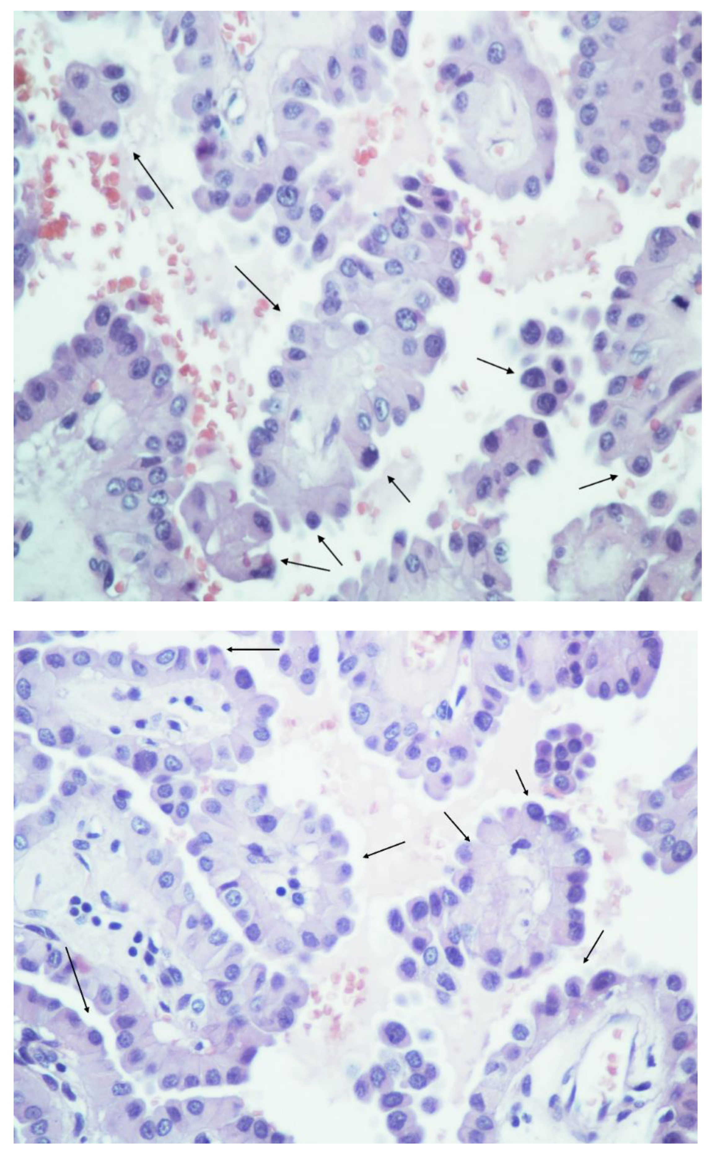 Cancers 14 02785 g002