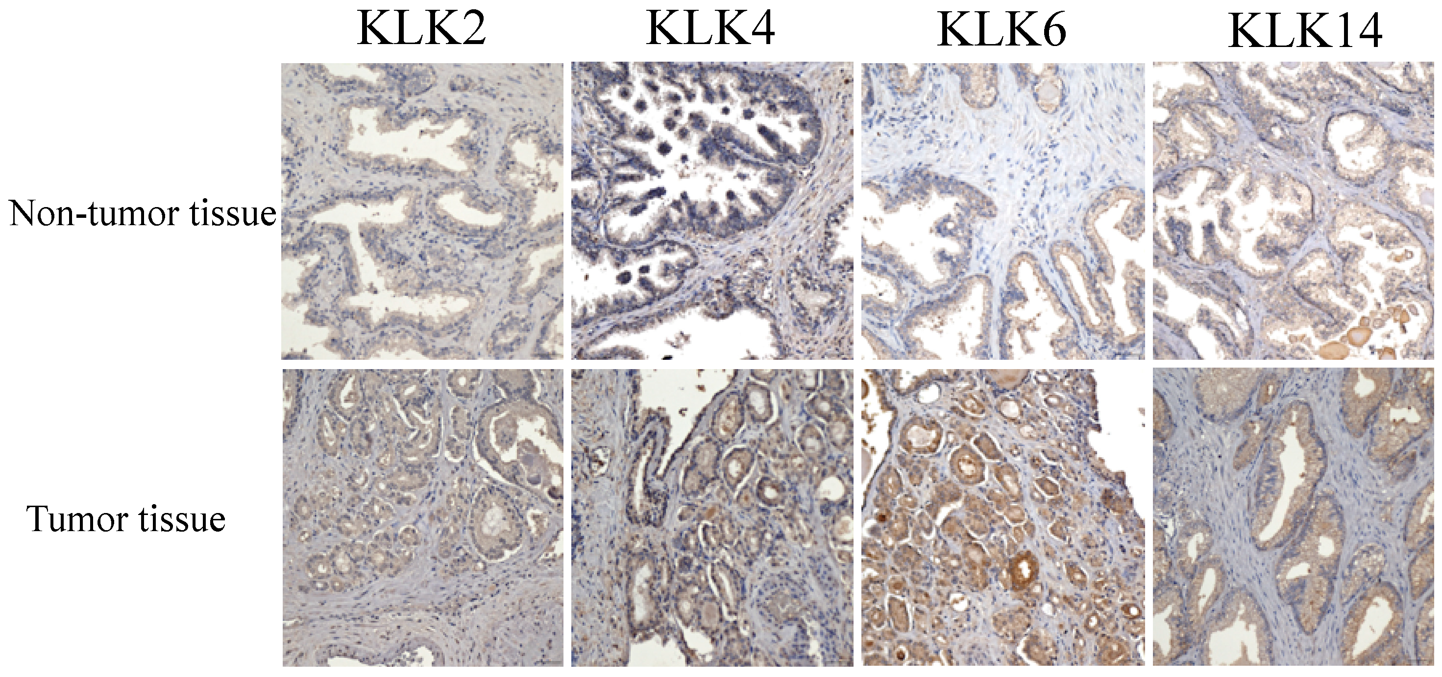 Cancers 14 02813 g004