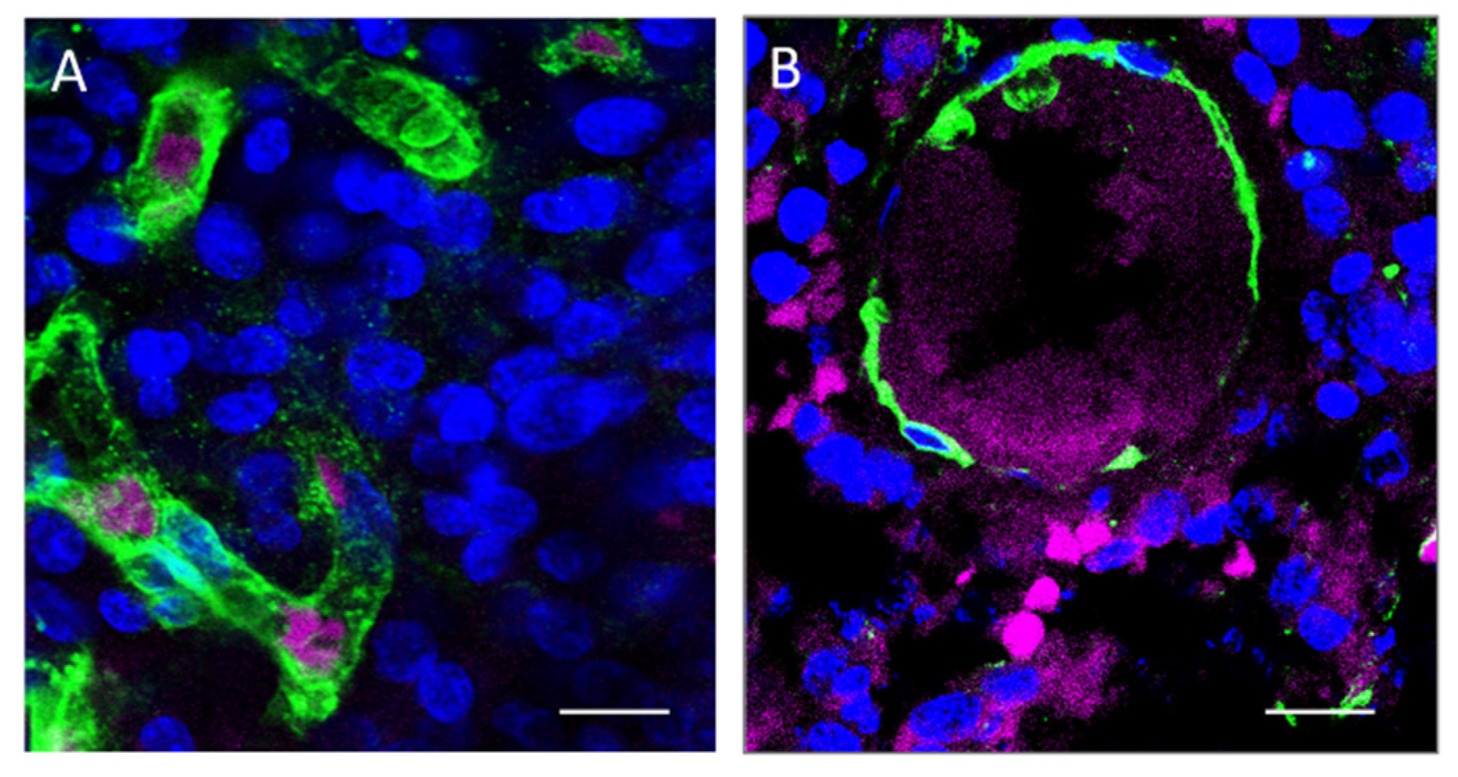 Cancers 14 02844 g002