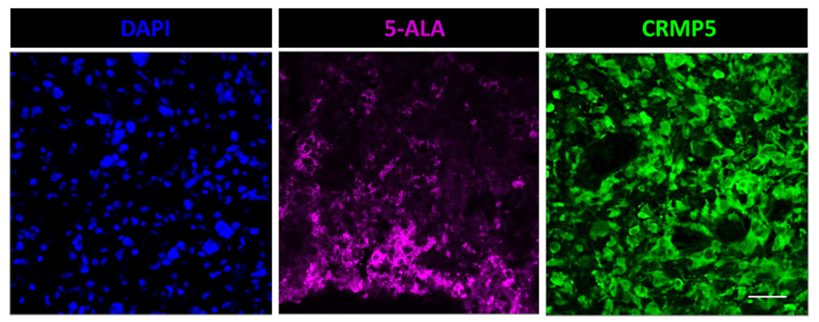 Cancers 14 02844 g003