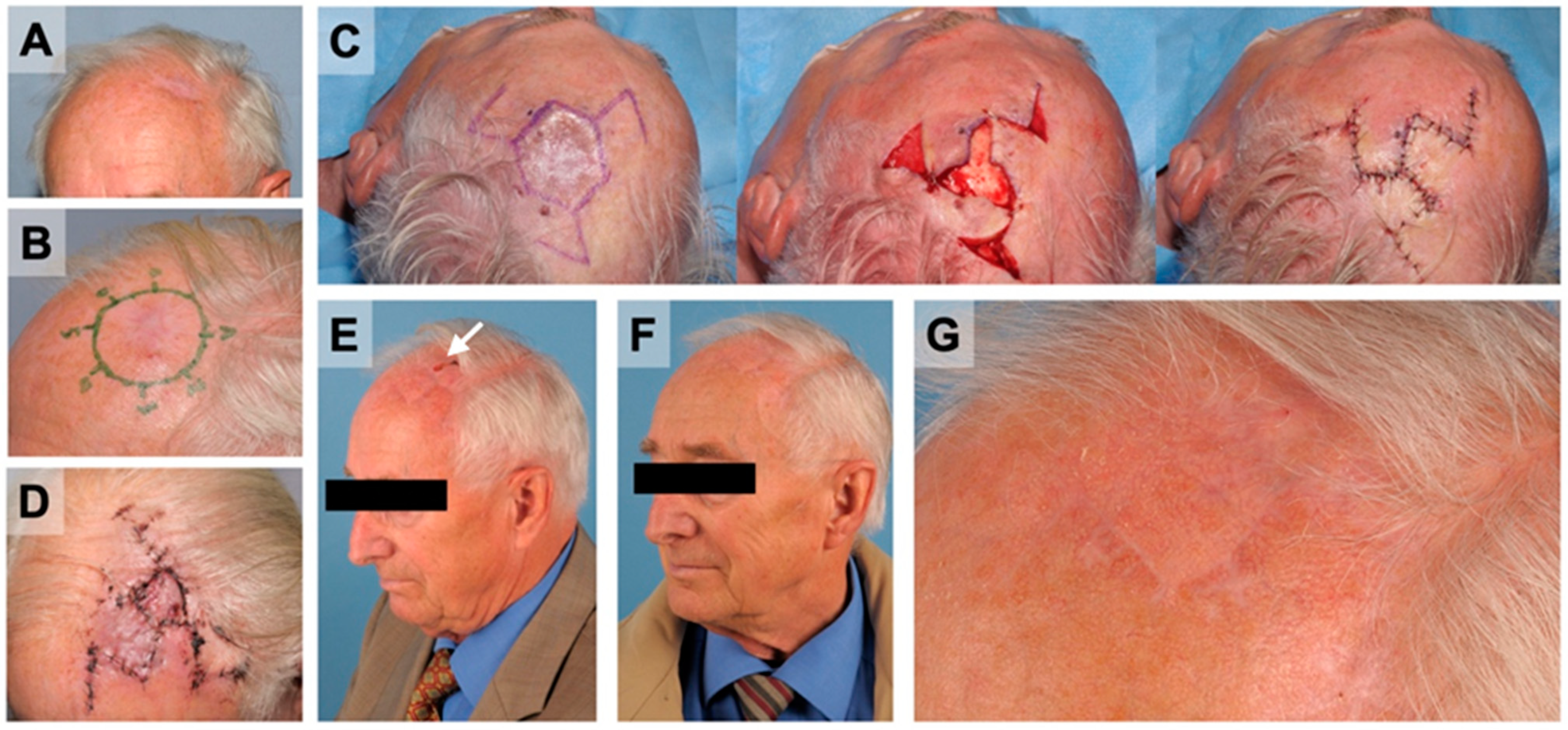 Cancers 14 02869 g003