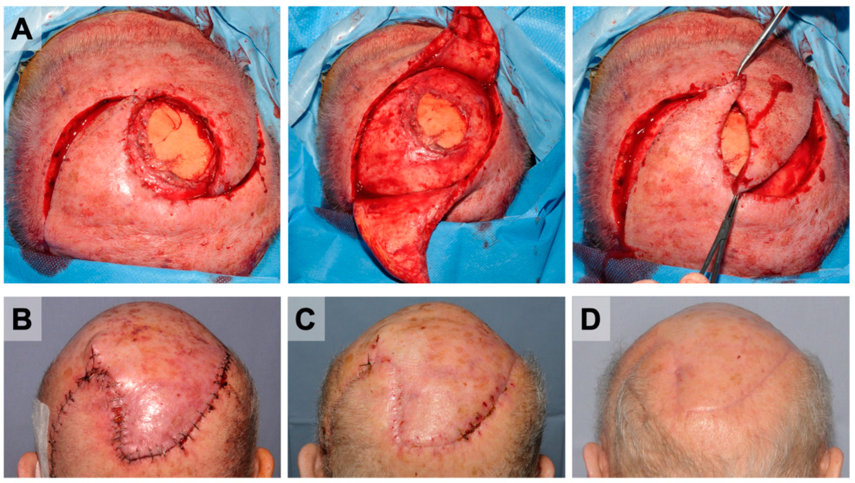 Cancers 14 02869 g004